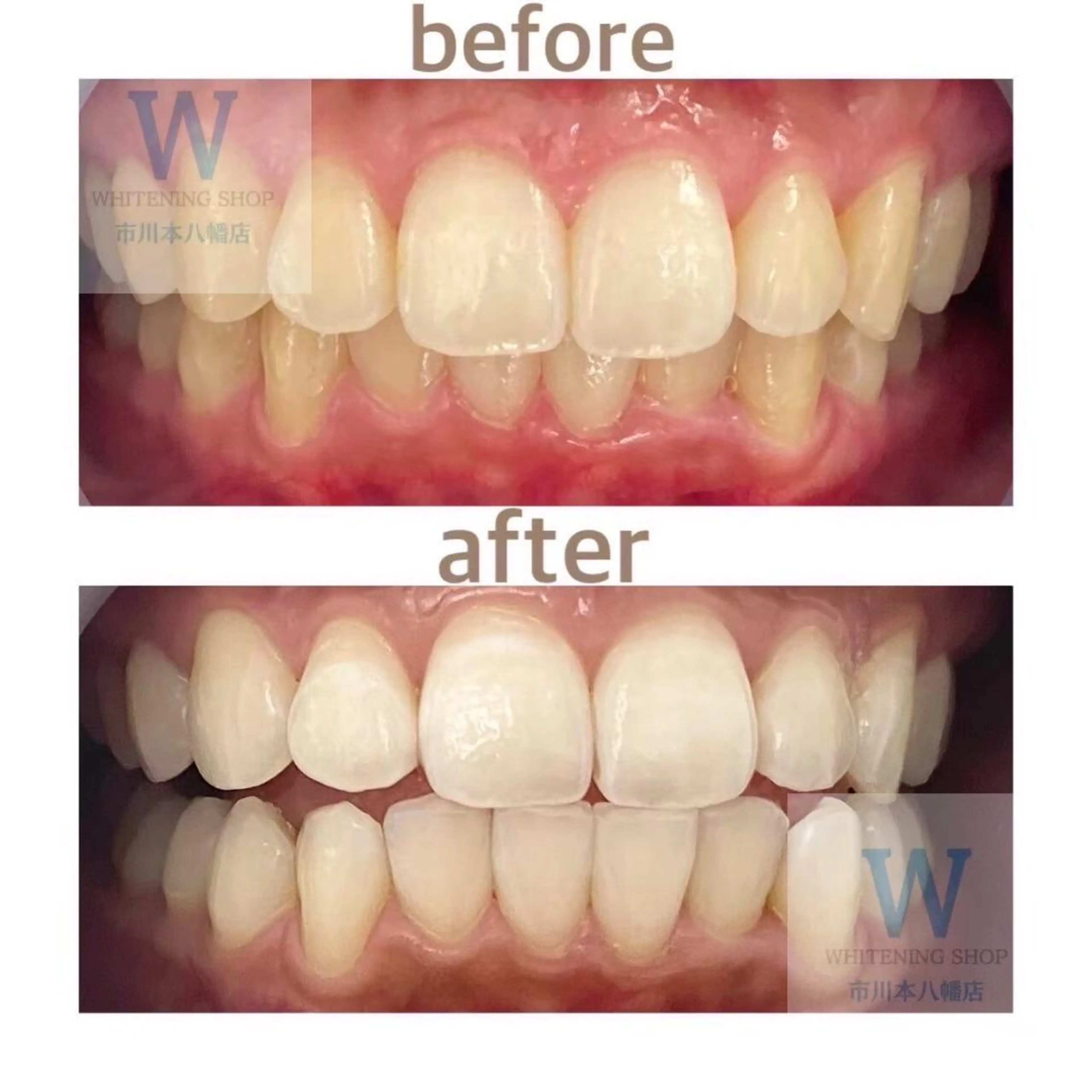 ホワイトニング ショップ本八幡店のエステ・リラクイメージ