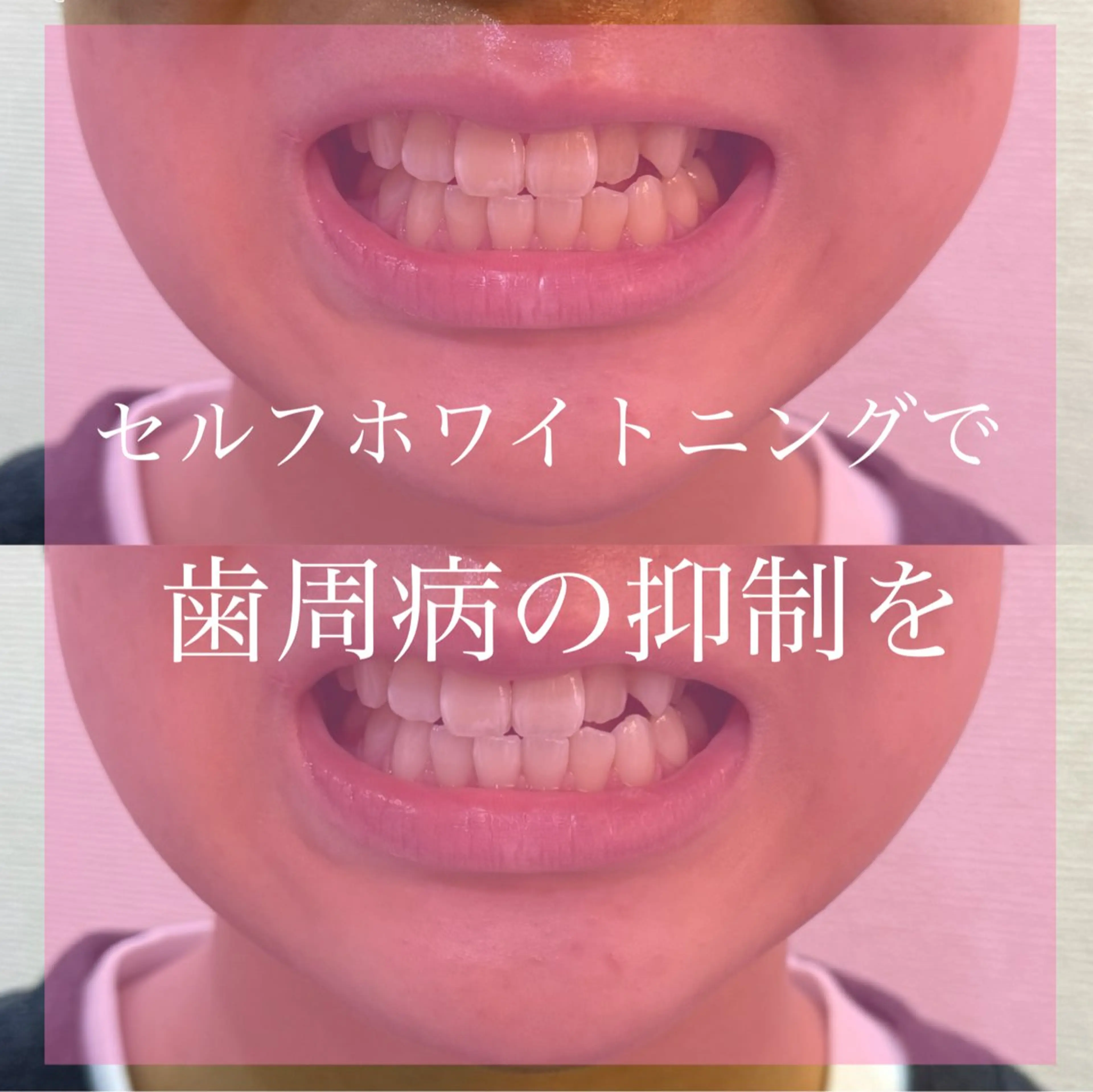 Livicate 💗🧁🎀🦋のマツエク・マツパデザイン