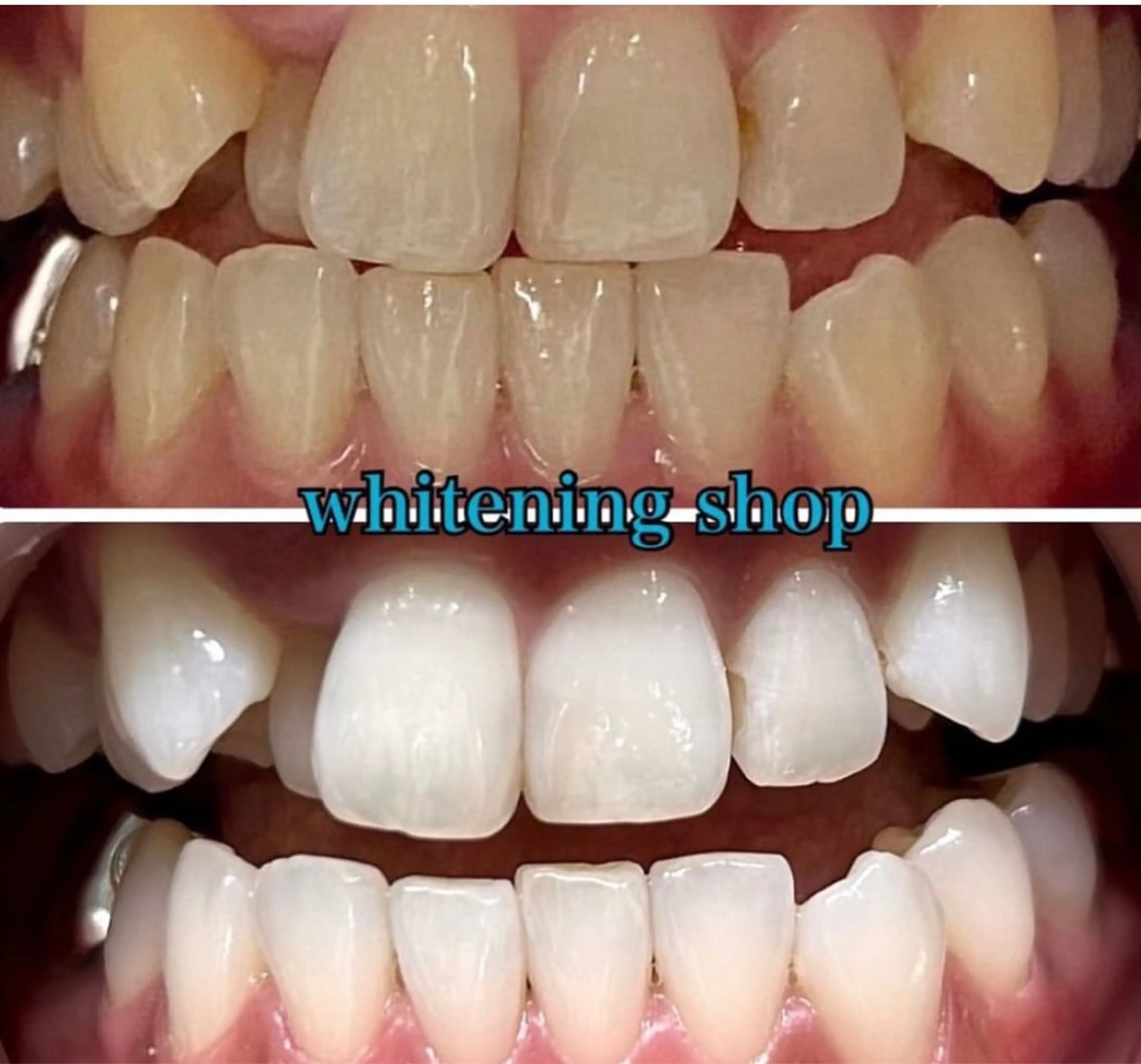 ホワイトニング ショップ伊丹店のその他イメージ