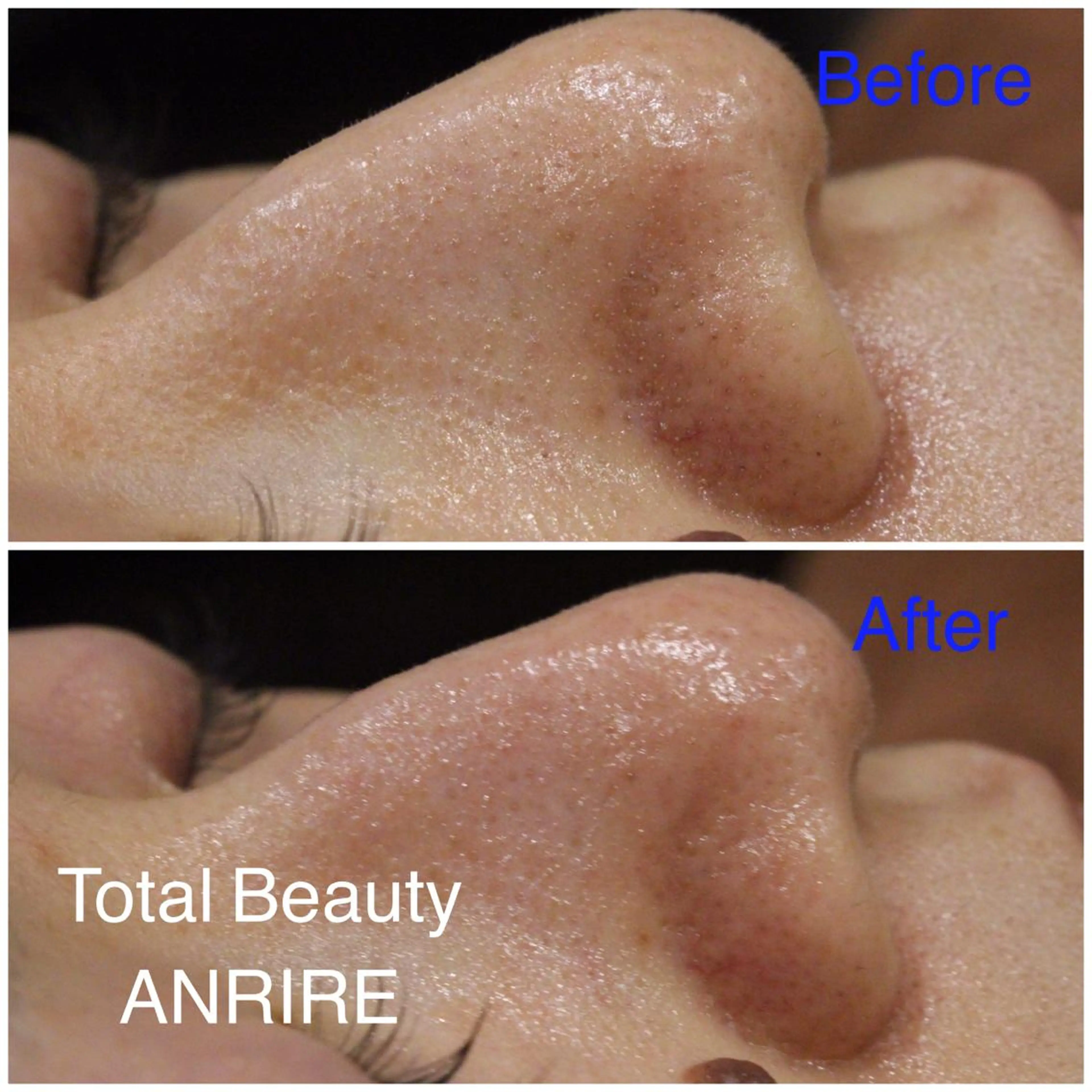 ANRIRE (アンリール)のエステ・リラクイメージ