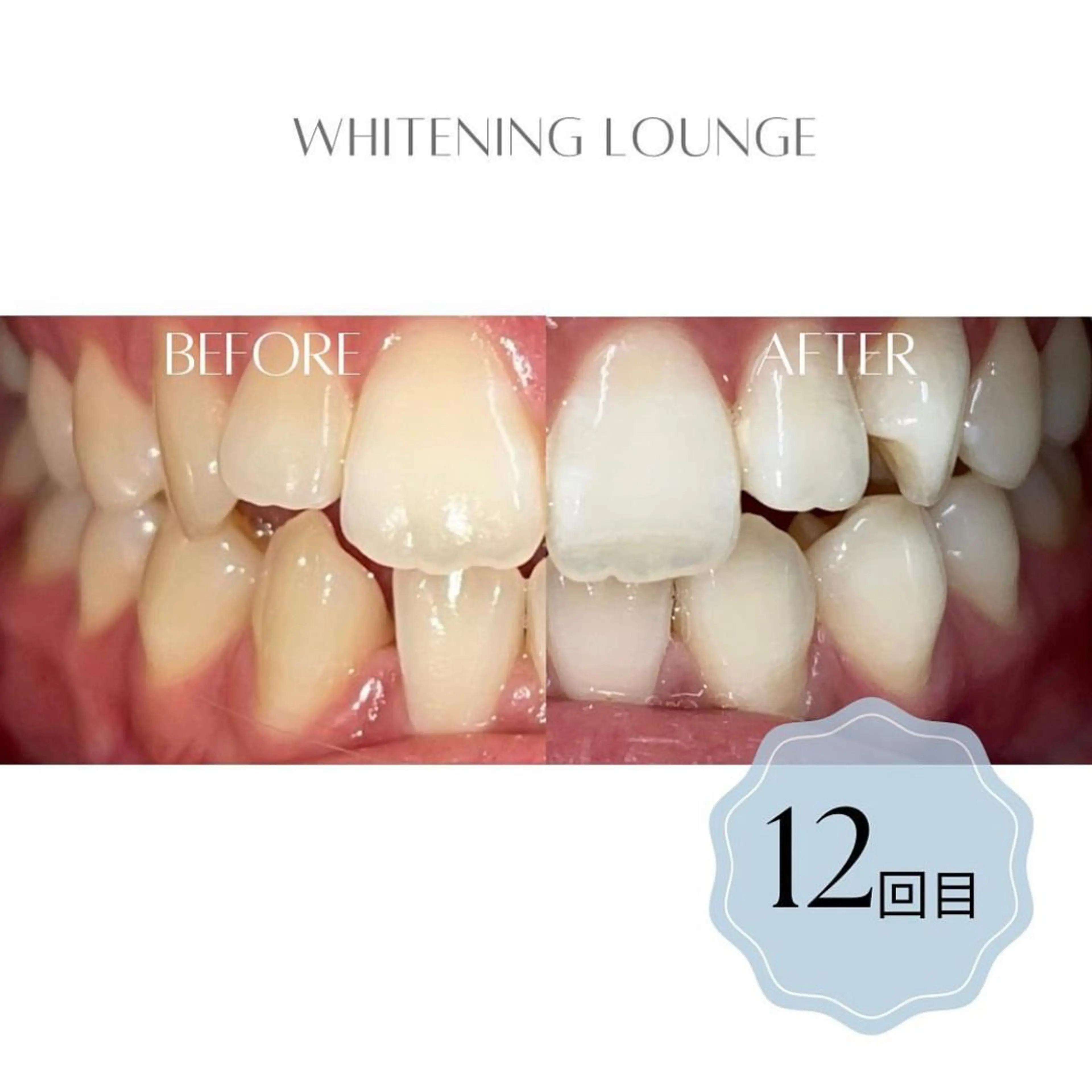 ホワイトニングラウンジ横須賀所属・ホワイトニング Lounge横須賀のエステ・リラクイメージ