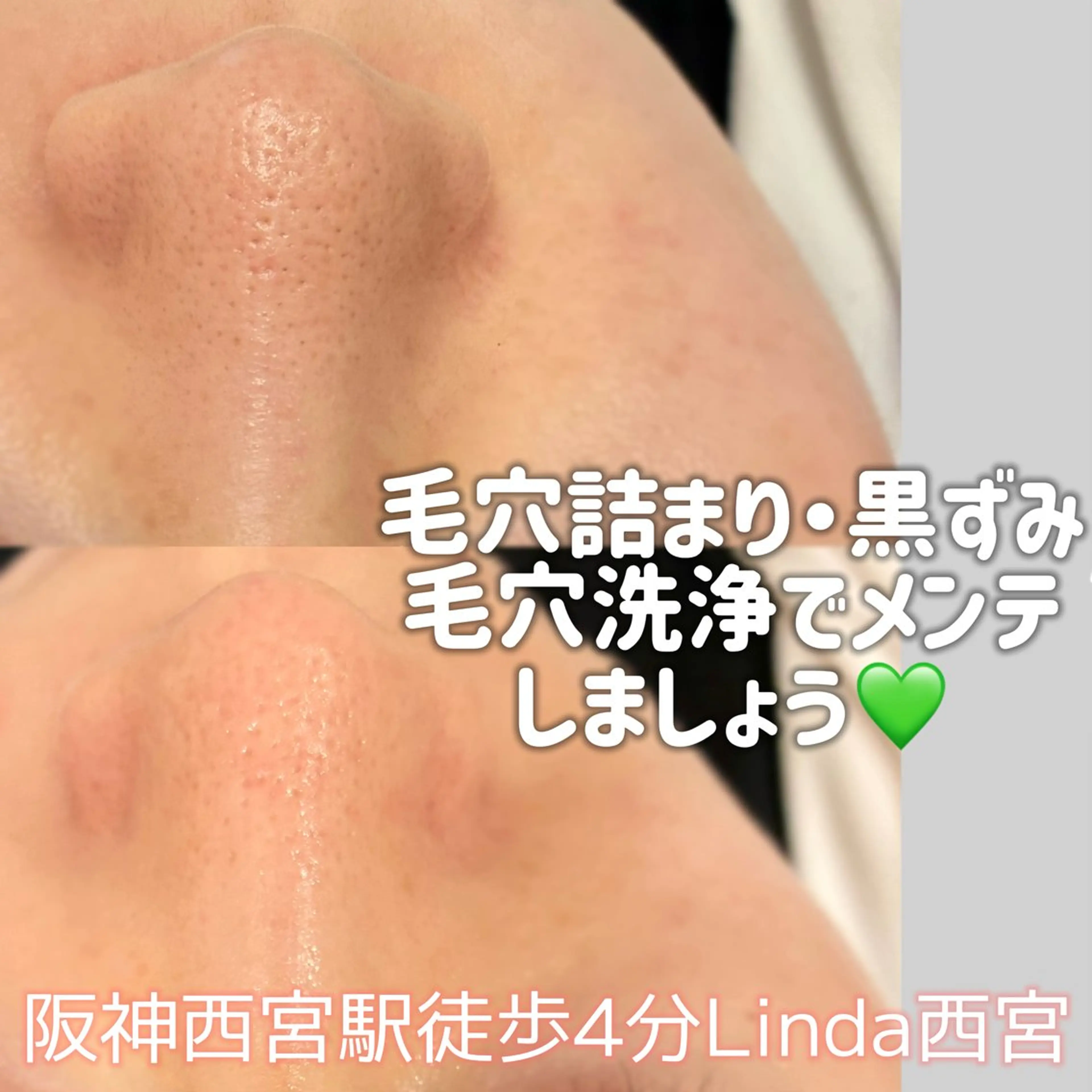 エステ 小顔&毛穴・肌質改善 LINDA西宮 AIのエステ・リラクイメージ
