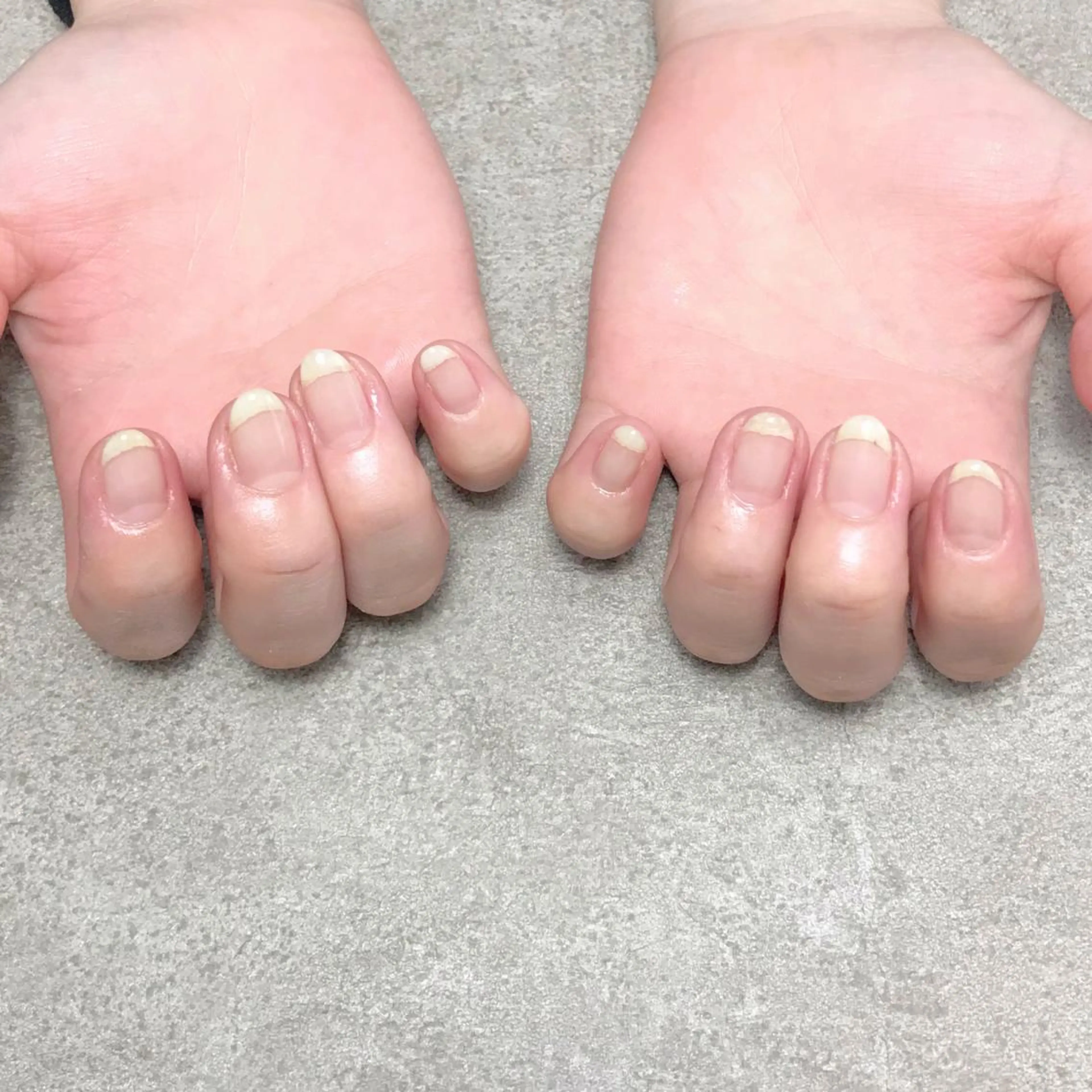 ネイル ハンドネイル nailroom DIASOMNIAのネイルデザイン