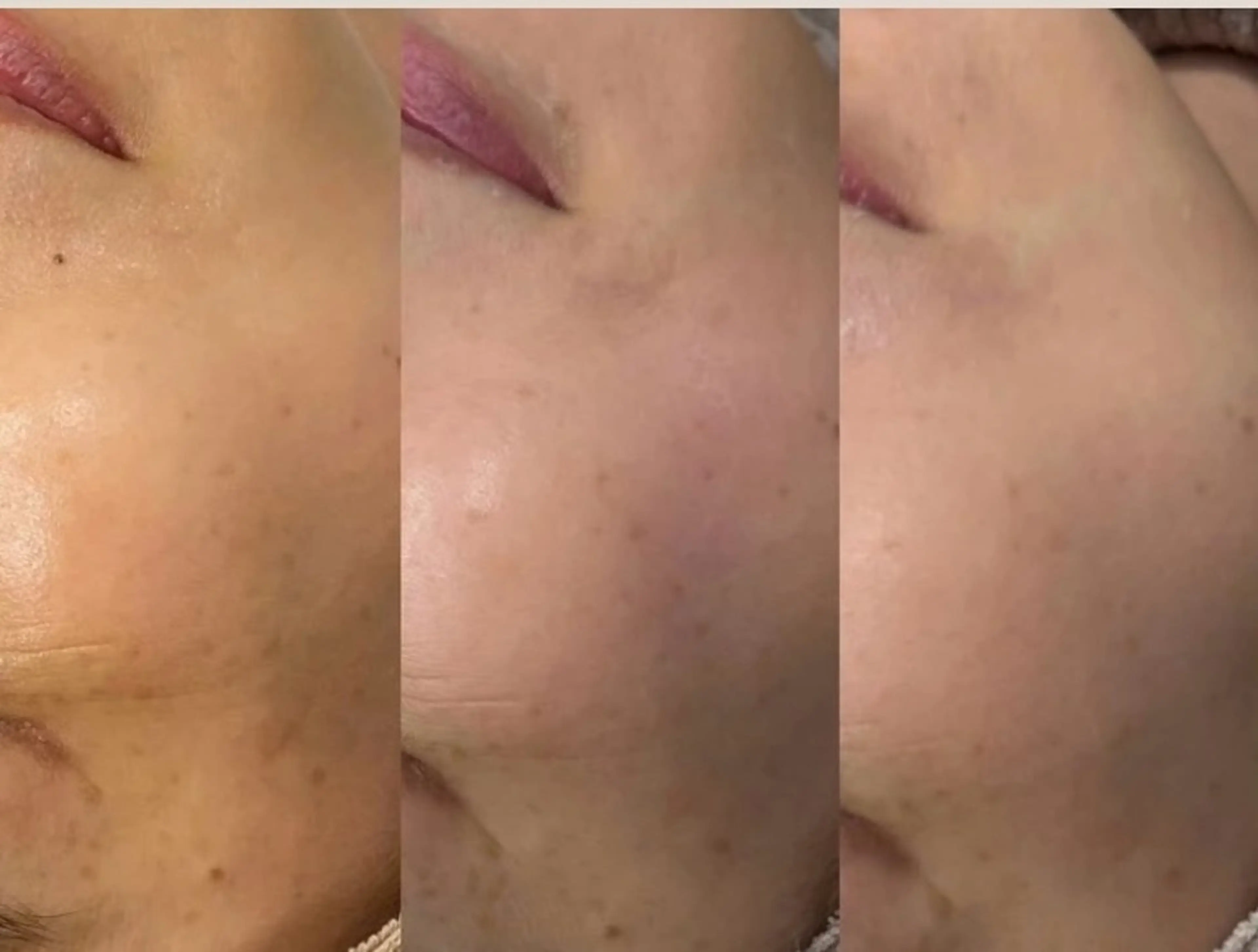 エステ NACHUL MANAのエステ・リラクイメージ