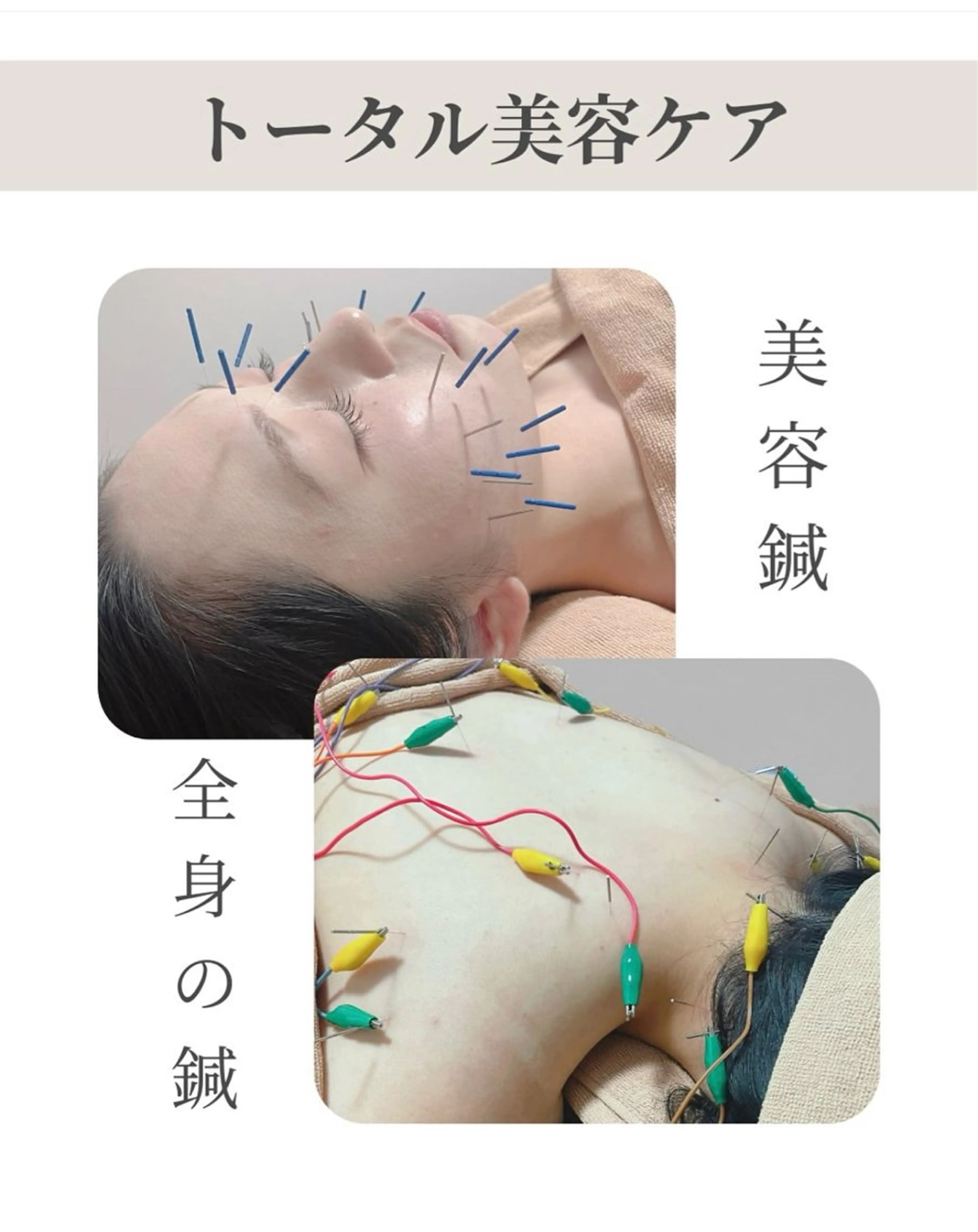 美容鍼/鍼灸 ここみ鍼灸院のエステ・リラクイメージ