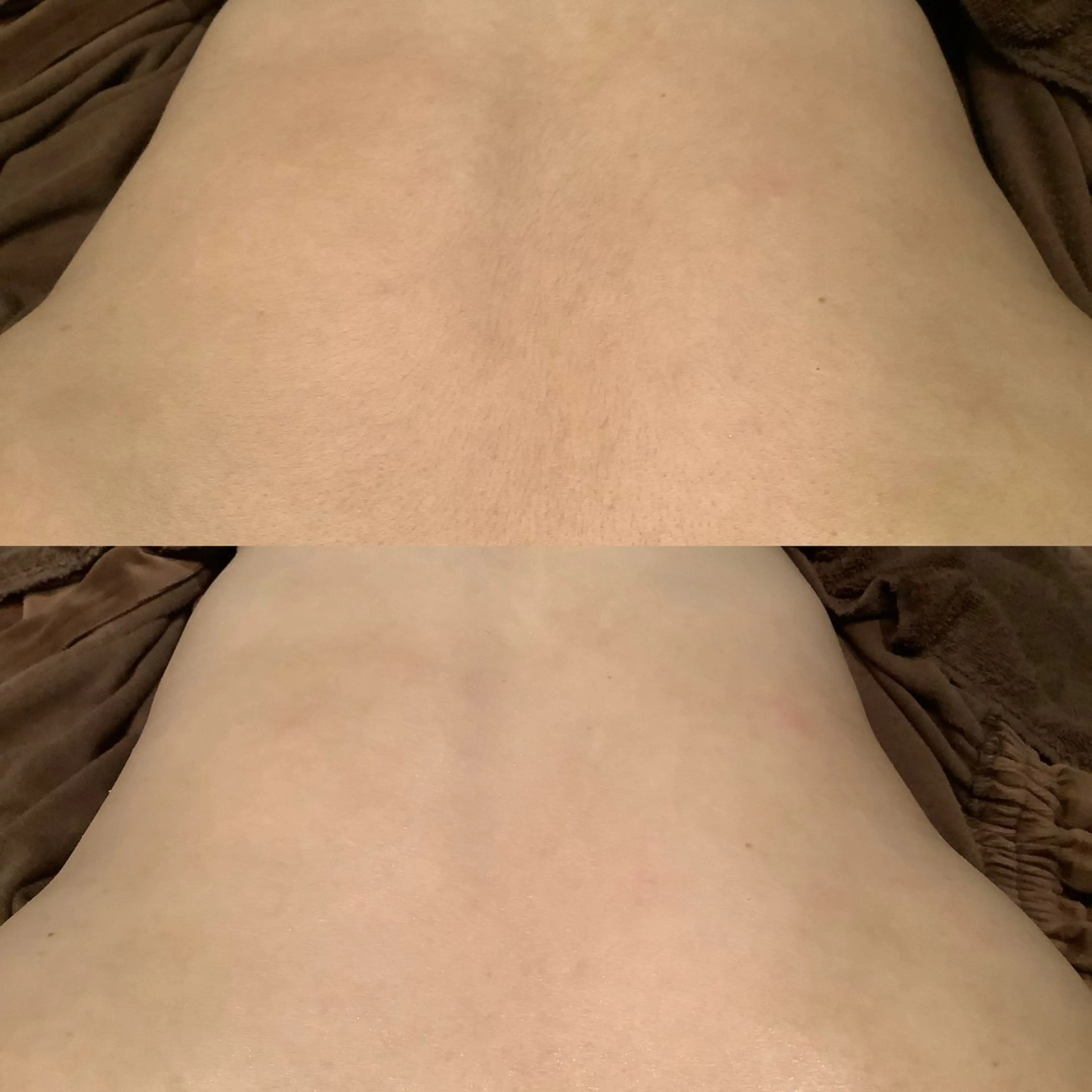 襟そり、背中シェービング(肩甲骨下まで)の写真