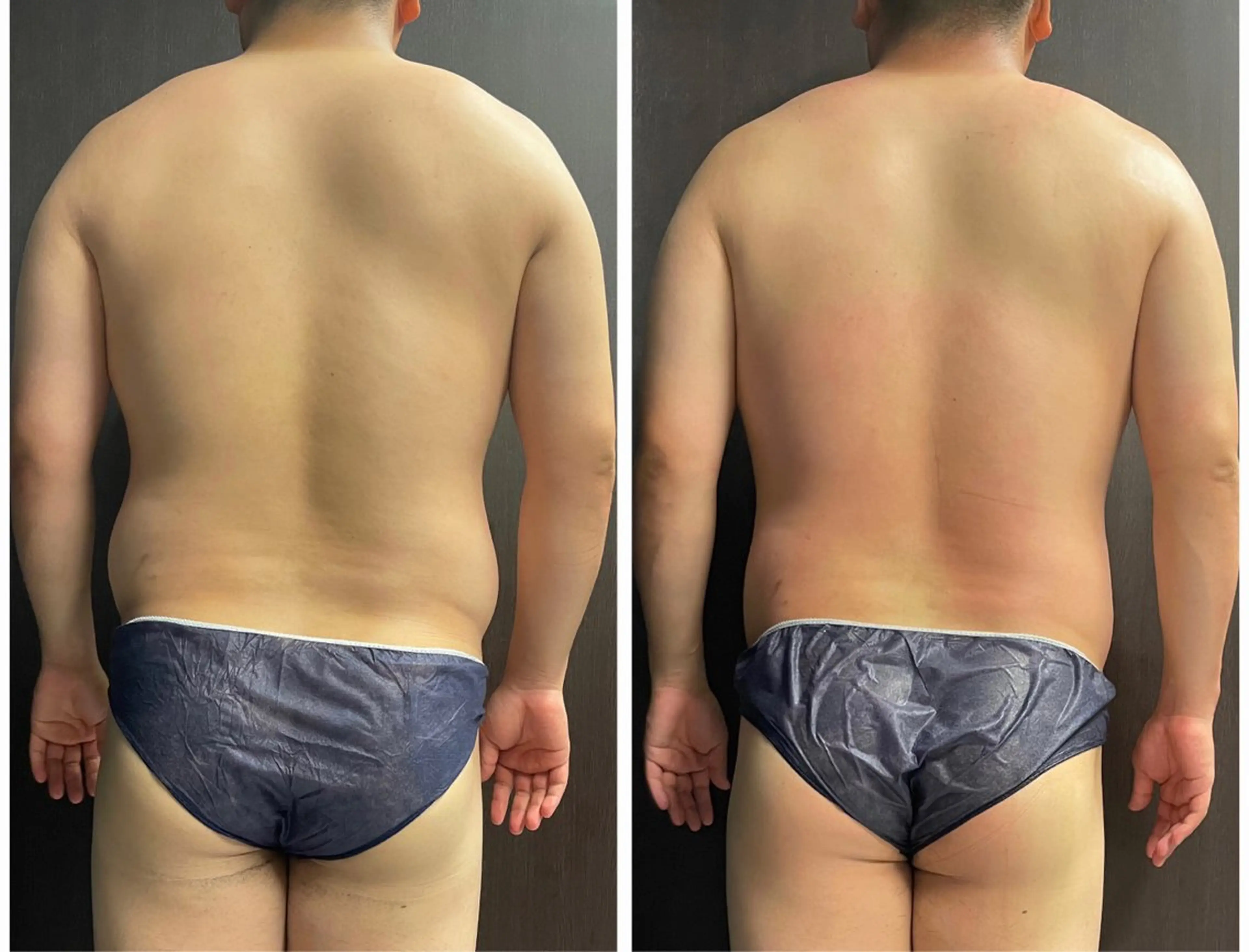 立体小顔×艶肌×美ボ ディ似合わせ施術 岡のエステ・リラクイメージ