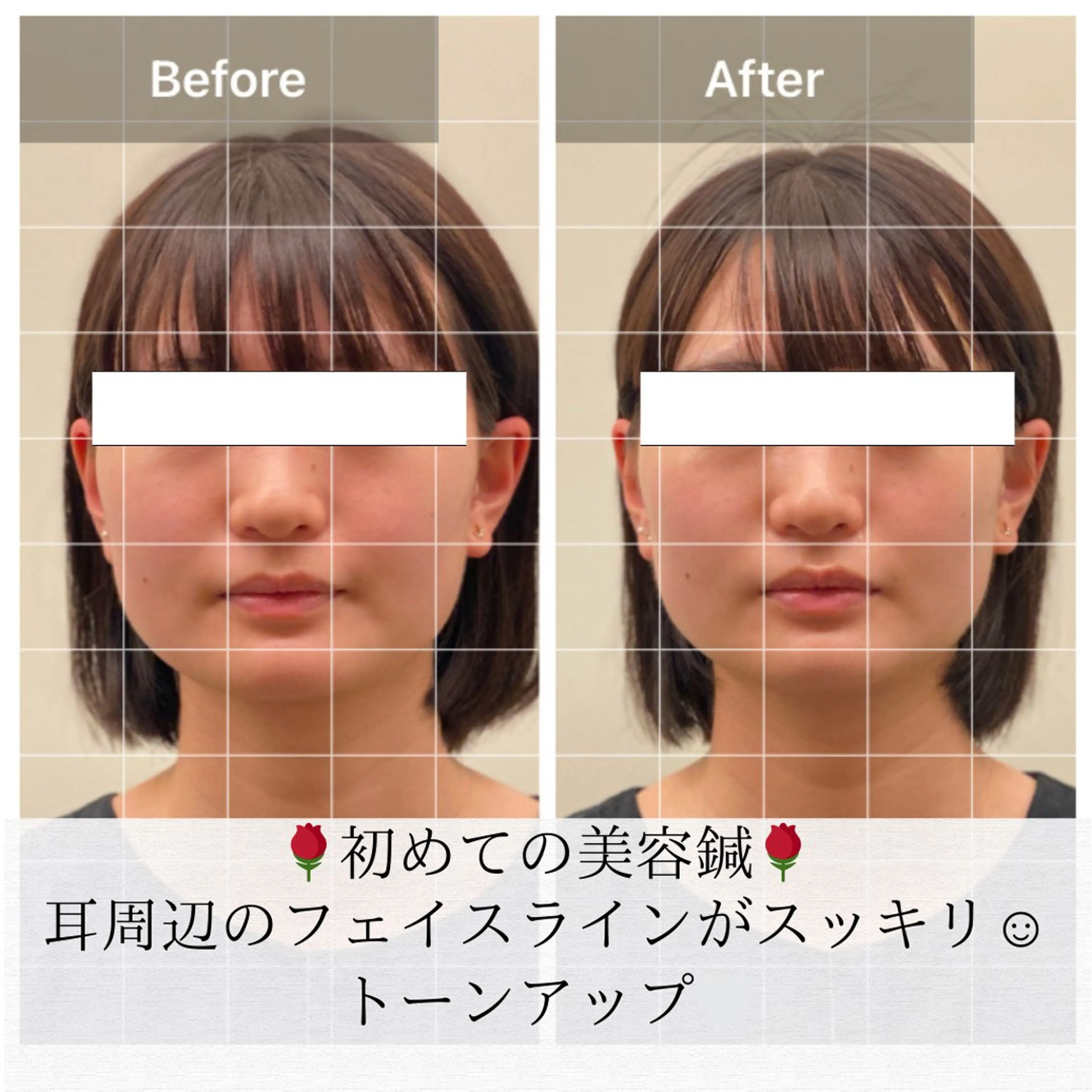 美容鍼/ヘッドスパ/ 💎さかもとのエステ・リラクイメージ