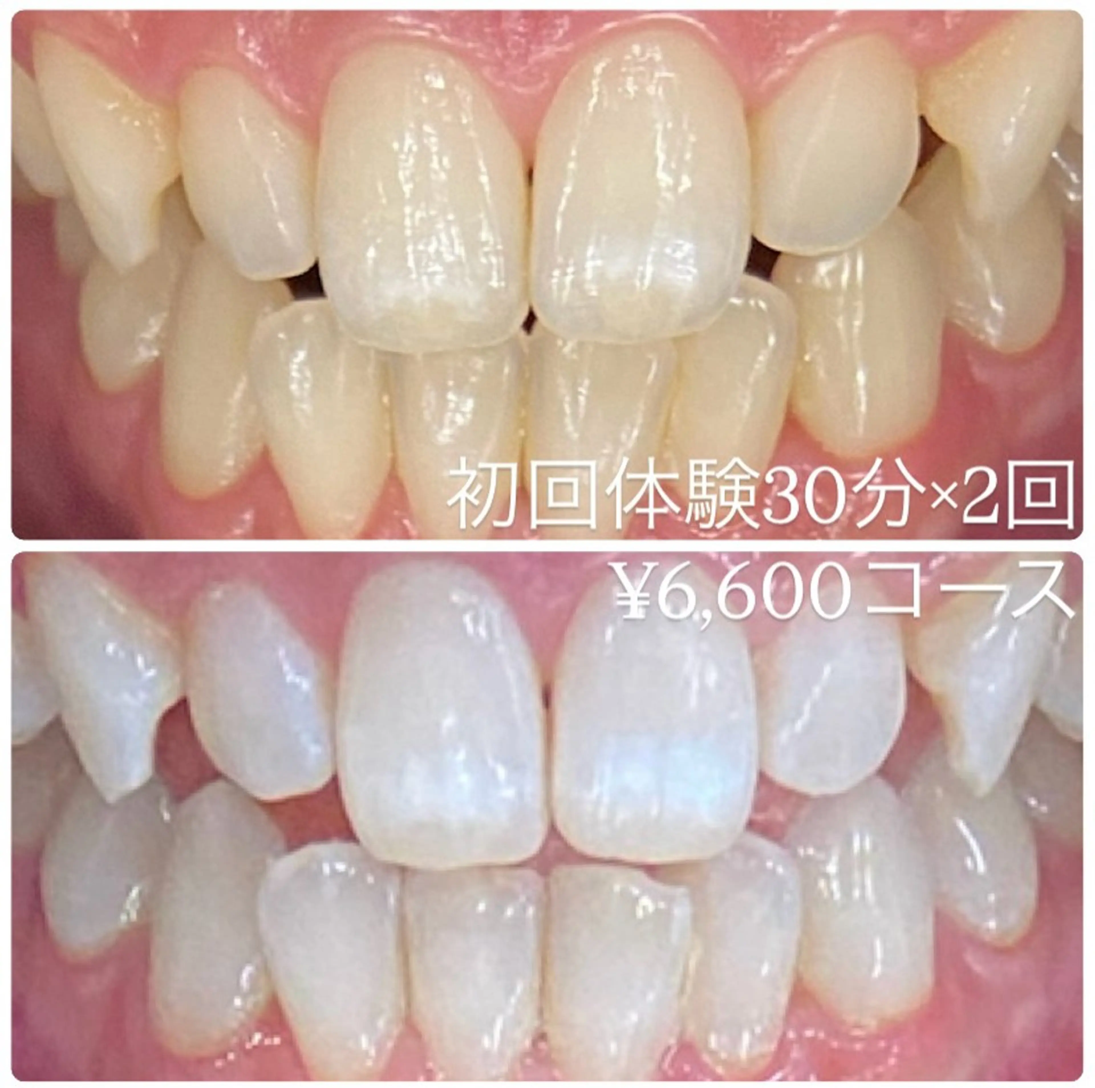 その他 PLATINUM Beauty 横浜店所属・ホワイトニングルーム 横浜店のその他イメージ