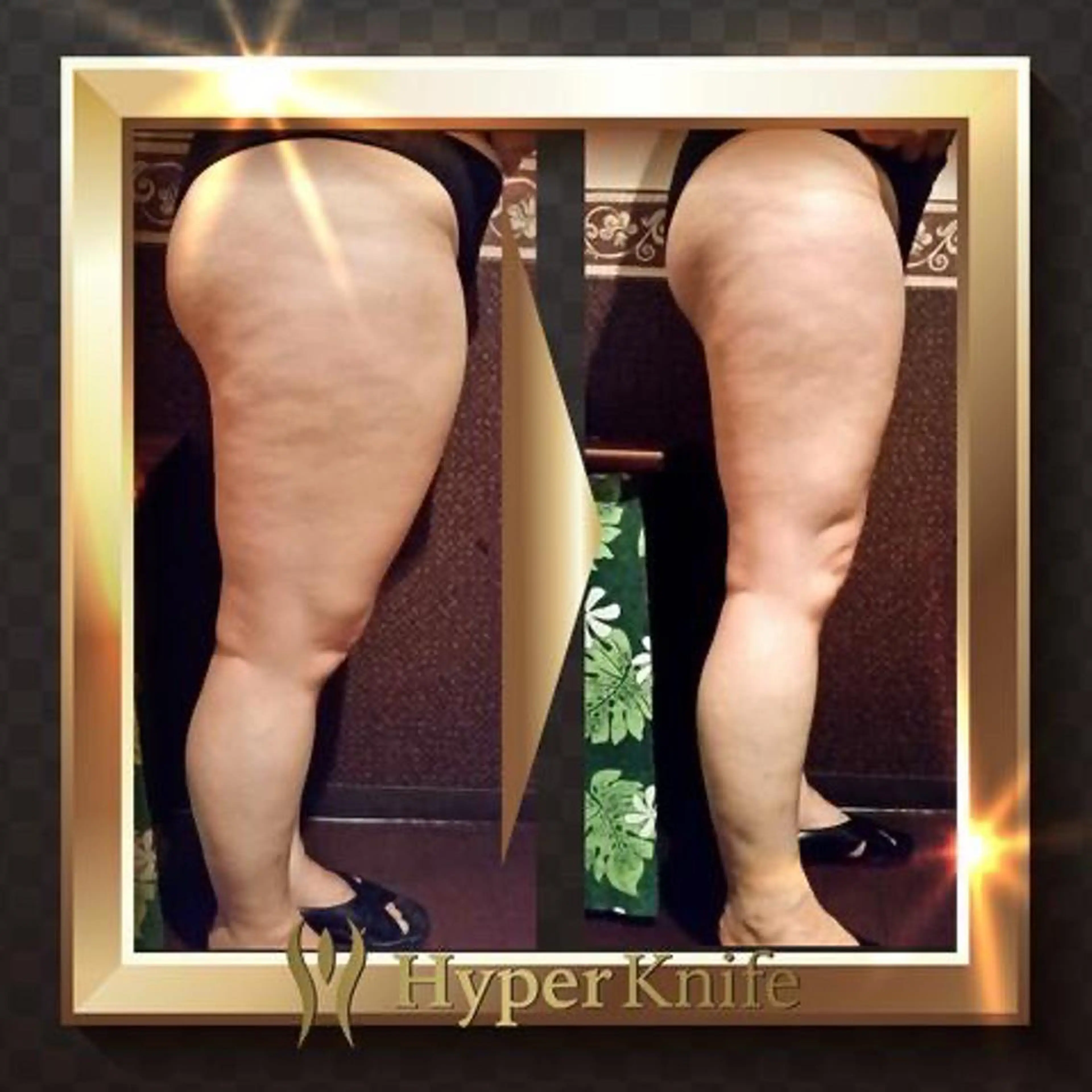 SILKY GLOW エステビューティのエステ・リラクイメージ