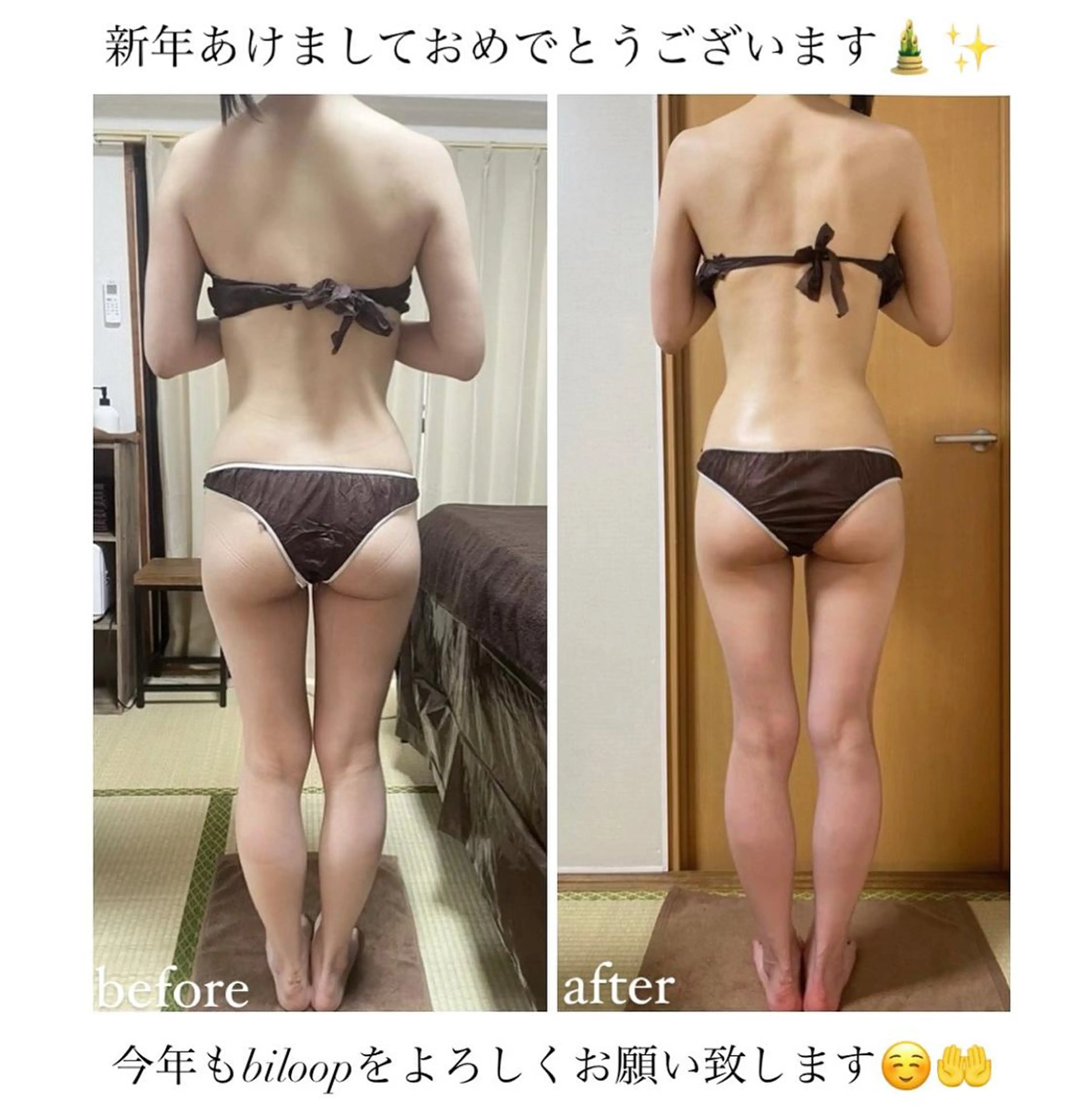 《本気痩せ×疲労改善 》  BILOOPのエステ・リラクイメージ