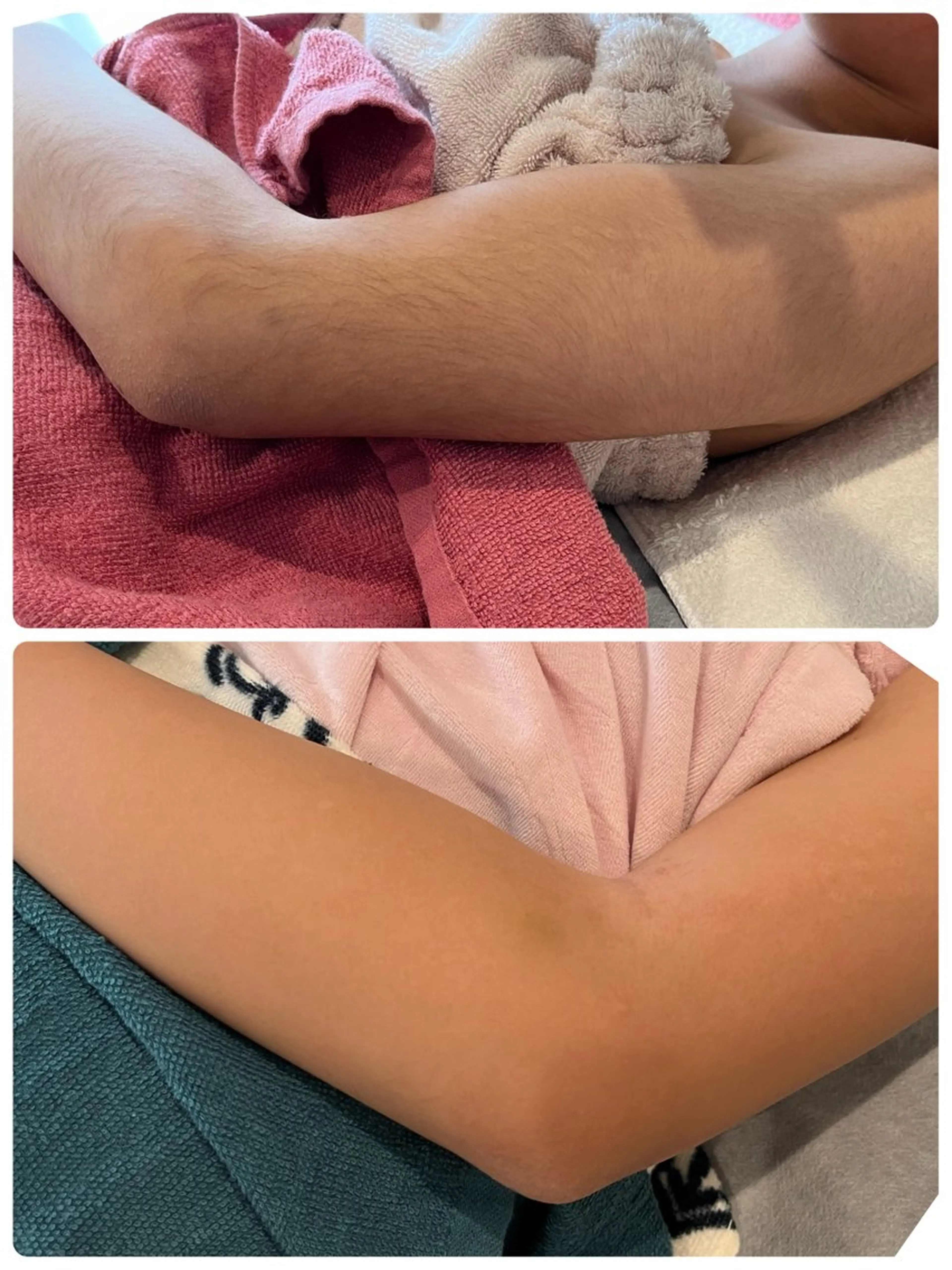 脱毛 Dione 立川店のエステ・リラクイメージ