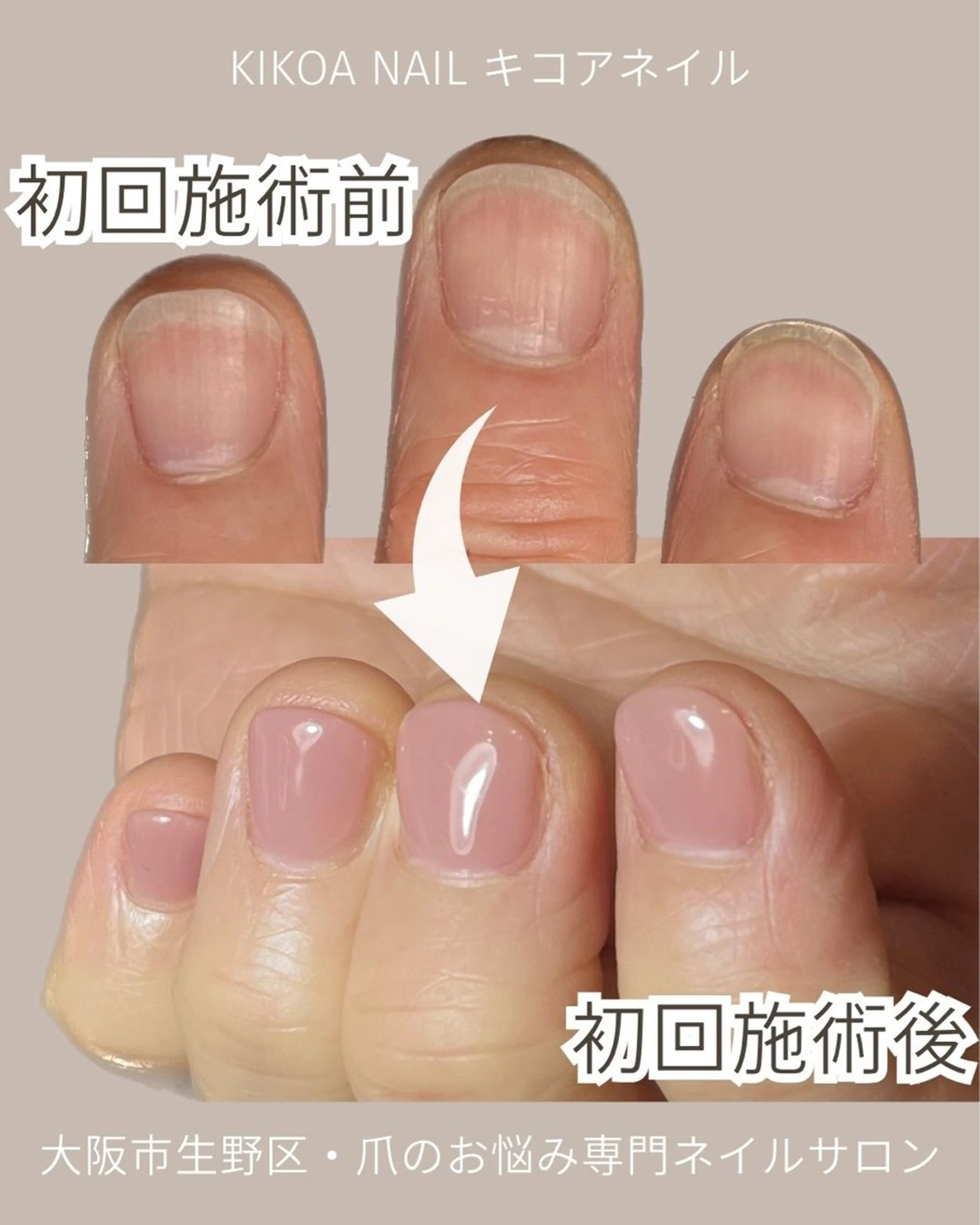 ネイル KIKOA NAIL キコアネイルのネイルデザイン