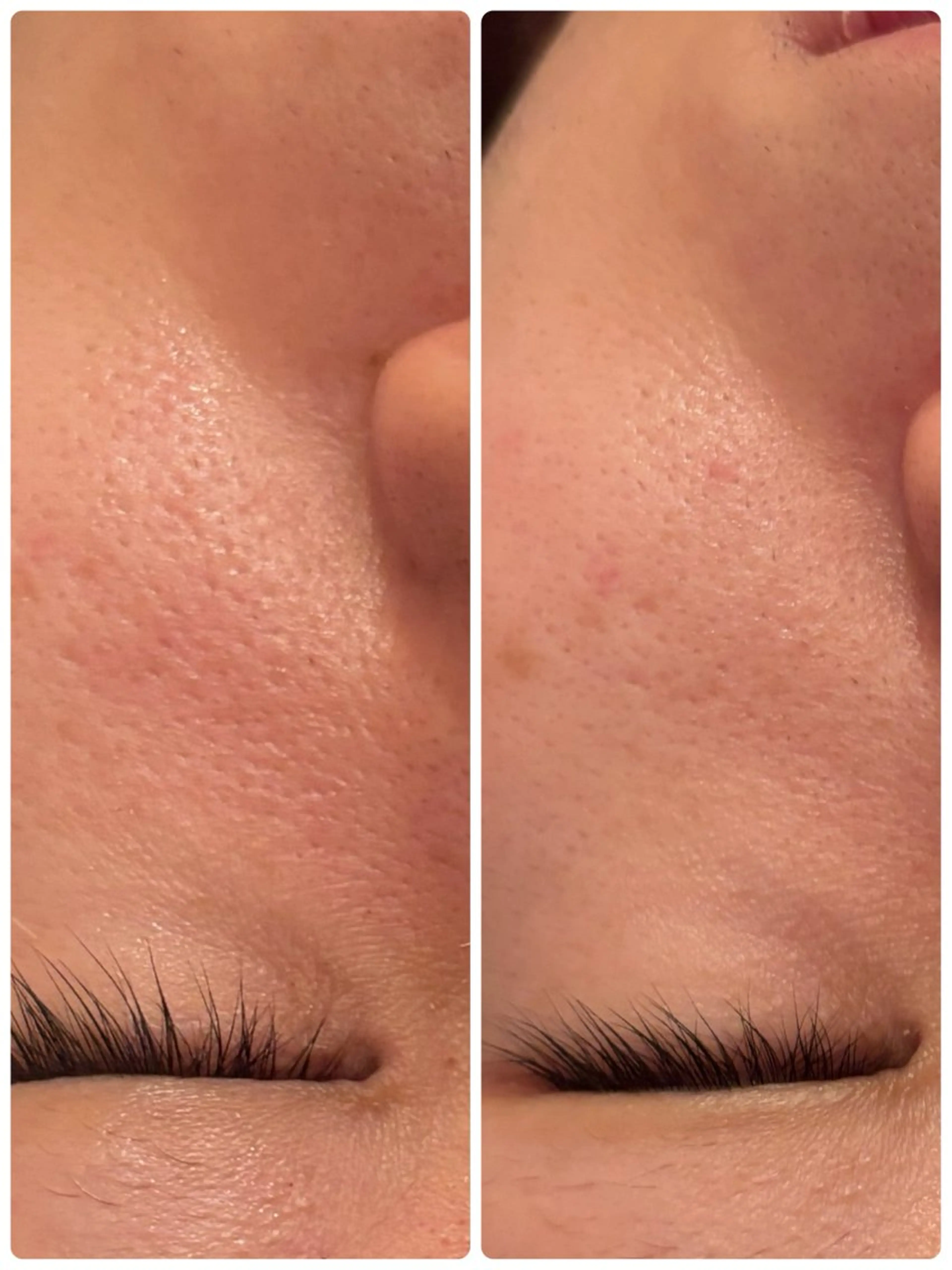 【Resetlab】 Chihiroのエステ・リラクイメージ