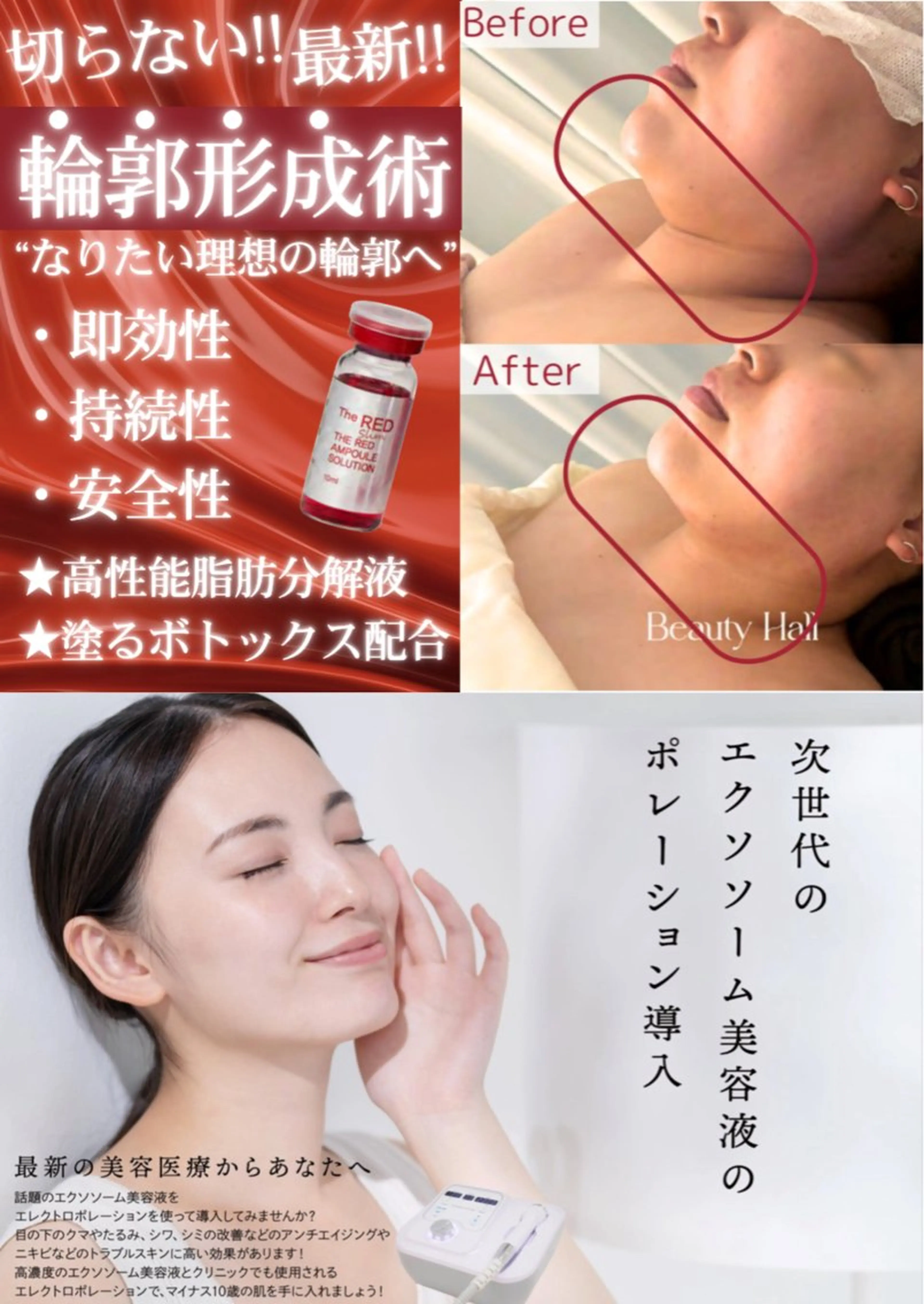 最強小顔ケア❤️‍🔥脂肪ぶん解レッドショット✖️エク◯ソーム✖️ヒト◯細胞を最新機器で導入✨✨¥35,200の写真