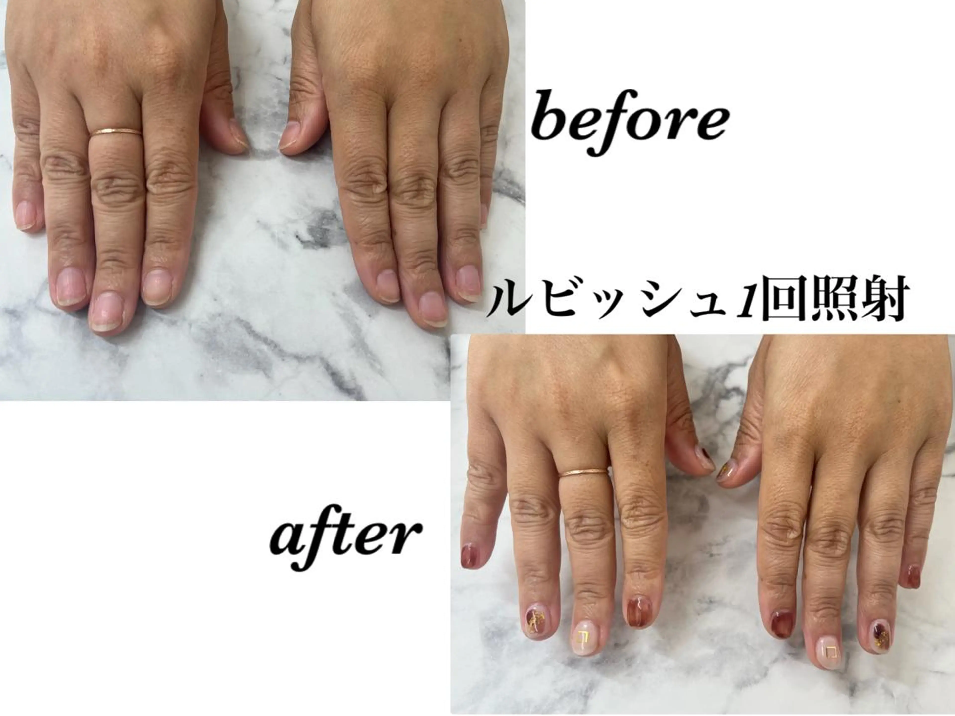 ネイル Regene ARAKIのネイルデザイン