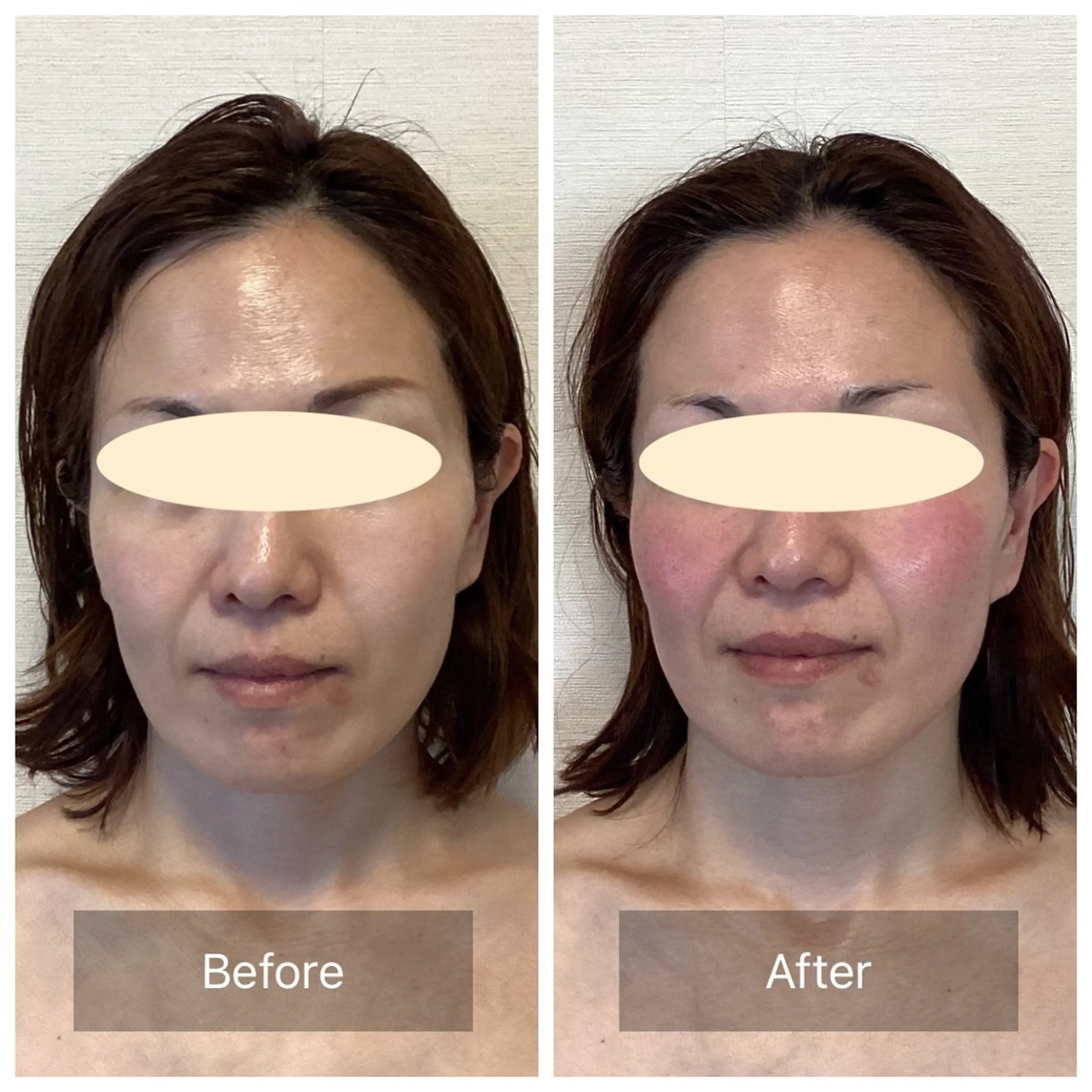 エステ リラク 小顔・歪み専門　井元 朋子のエステ・リラクイメージ