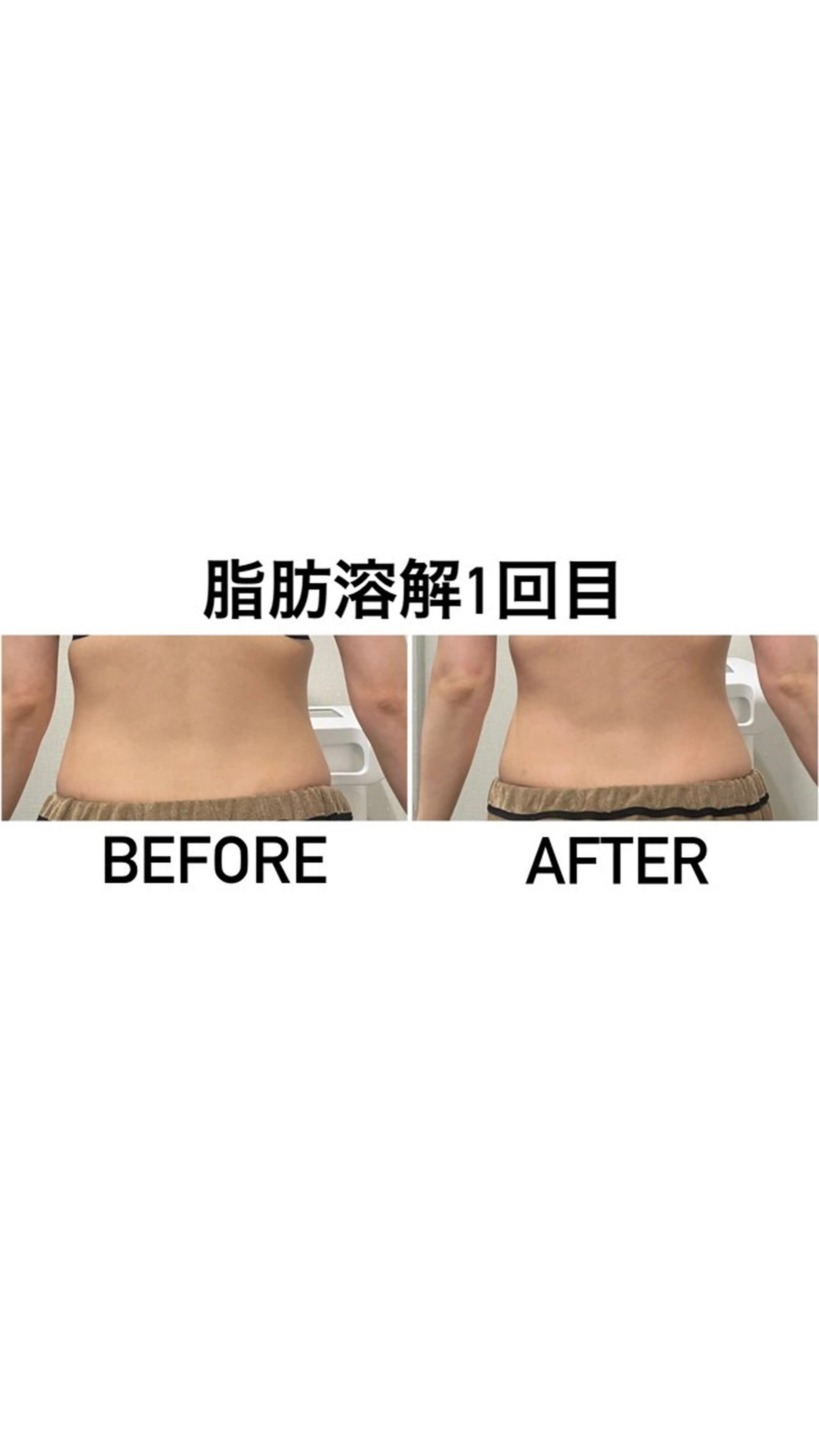 エステ 痩身/毛穴洗浄/脱毛 アルカンジュのエステ・リラクイメージ