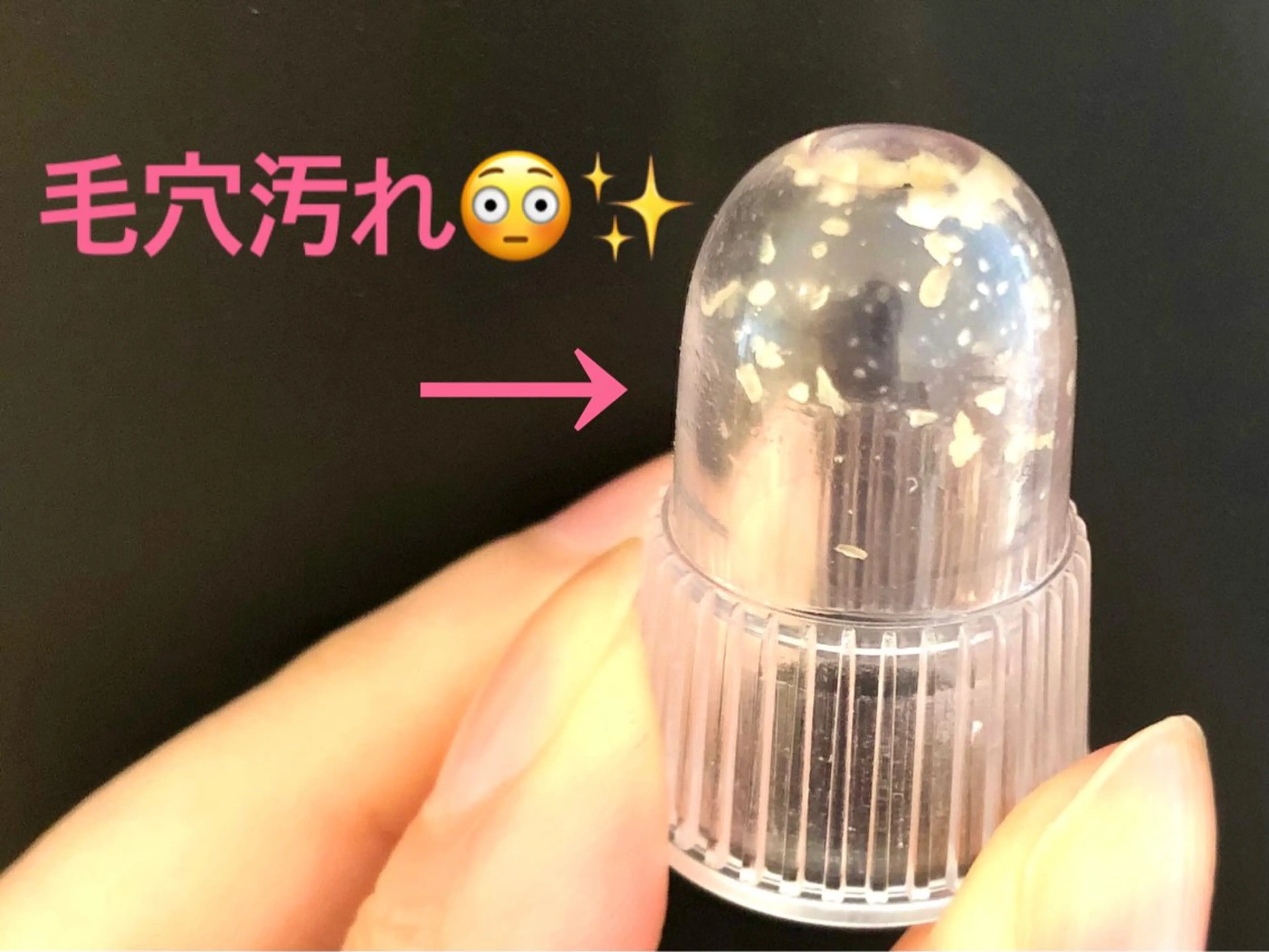 【角栓除去＋炭酸パックつき✨】大人気毛穴洗浄💖ザラつき毛穴を根こそぎ吸引🥺お仕上げは毛穴引き締め炭酸パック💖の写真