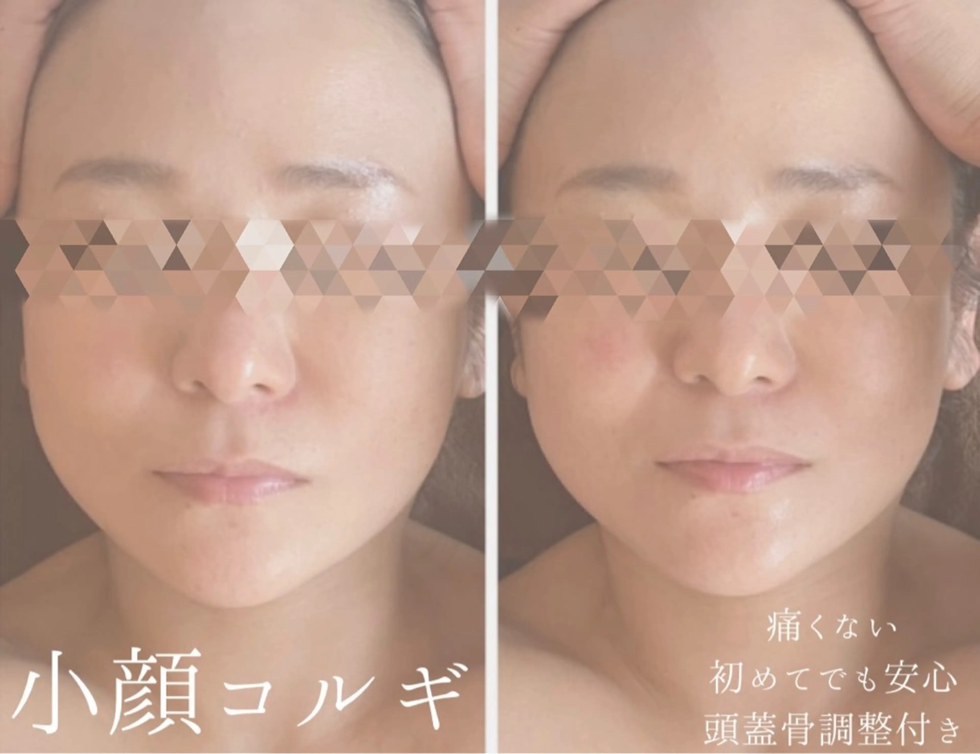 【即小顔/ *むくみスッキリ】痛くない！オーダーメイド小顔コルギ（鎖骨​〜​頭蓋骨まで施術）75分¥7.900の写真