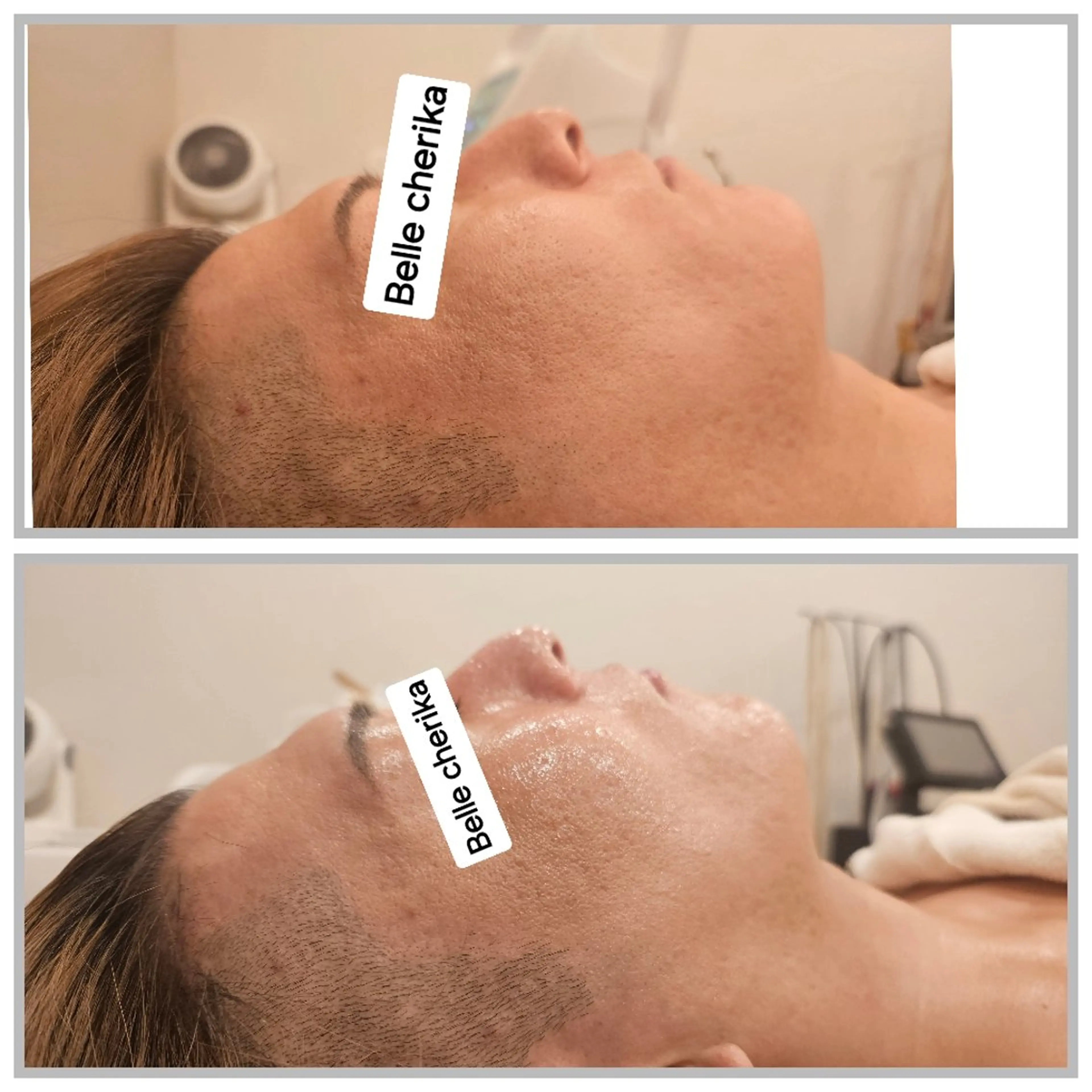 エステ ベル チェリカ 三城のエステ・リラクイメージ