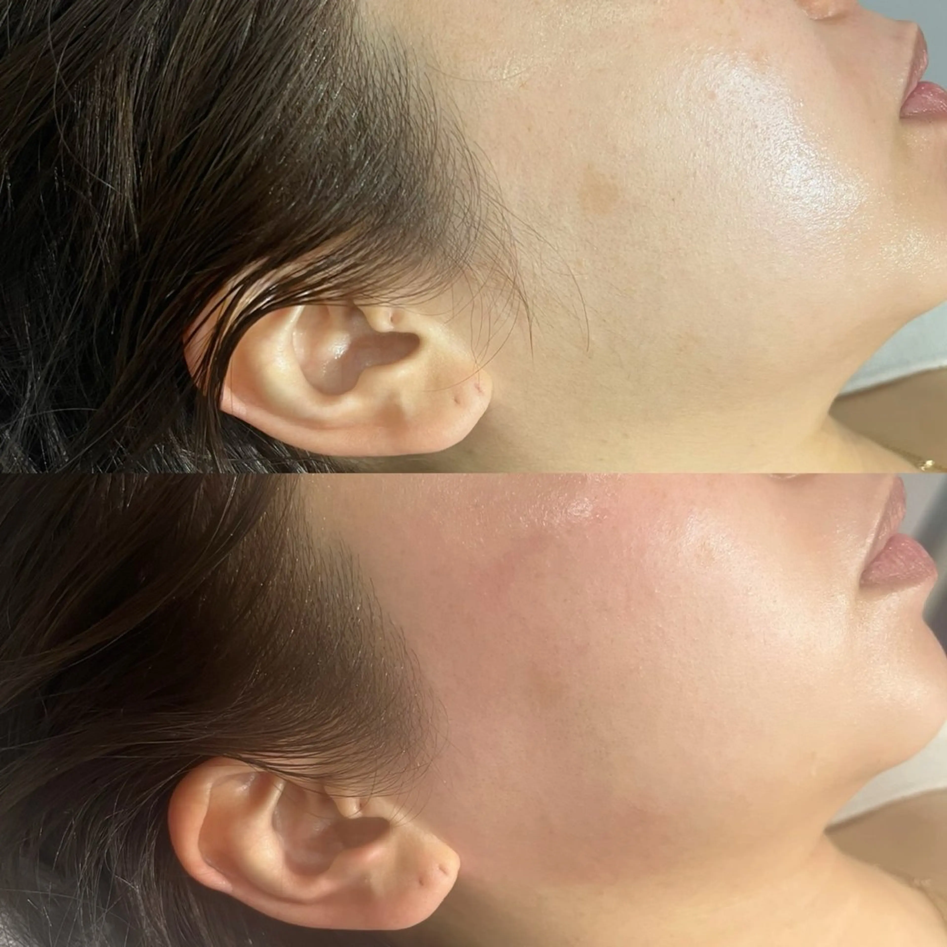 😶Face wax 2箇所✨の写真