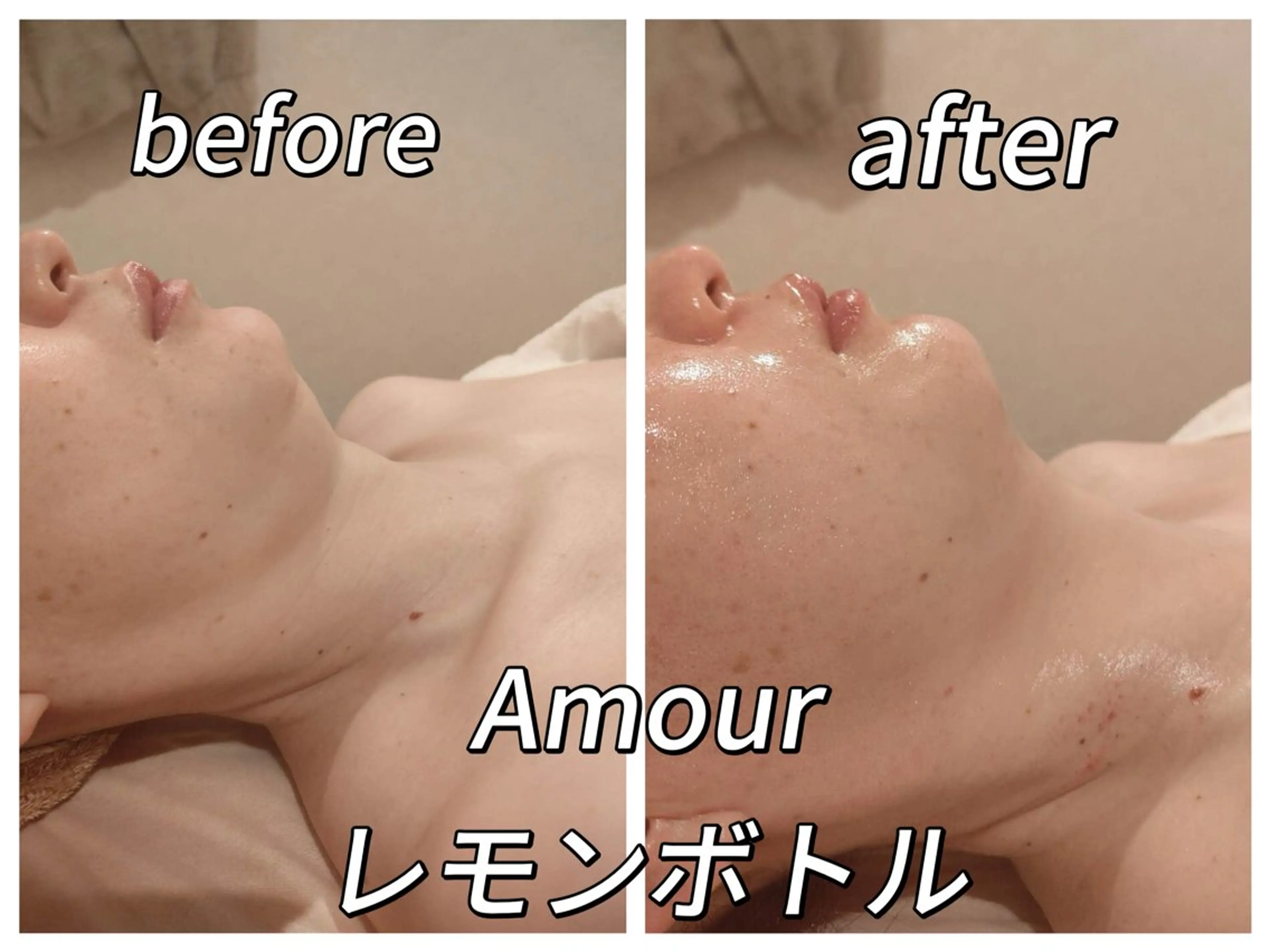 痩身・小顔・脱毛・ オイル&Amourのその他イメージ