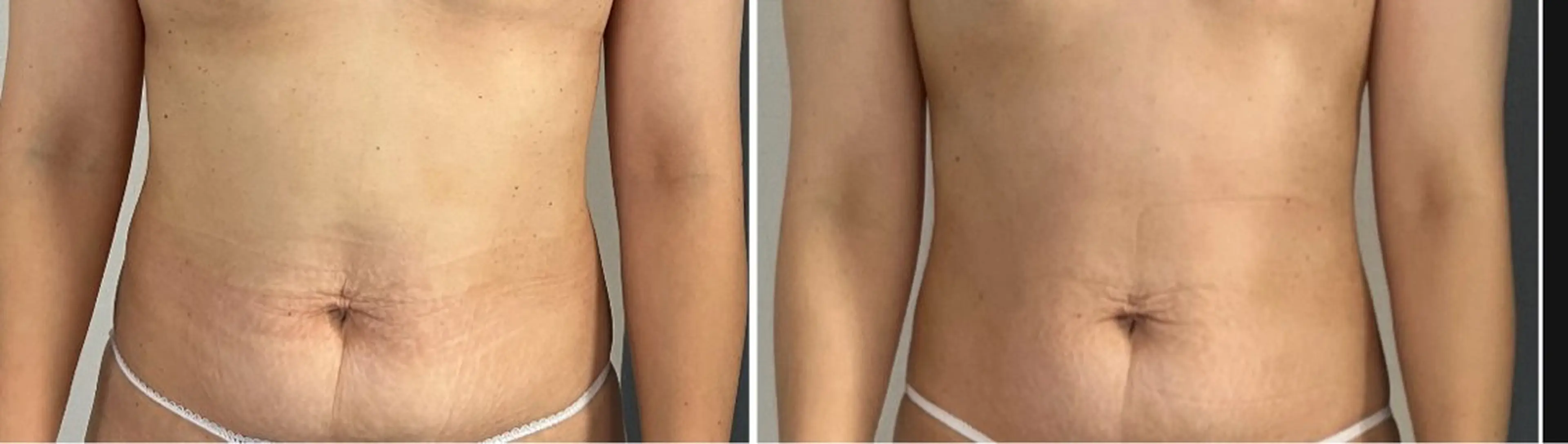 湘南エステサロン moaのエステ・リラクイメージ