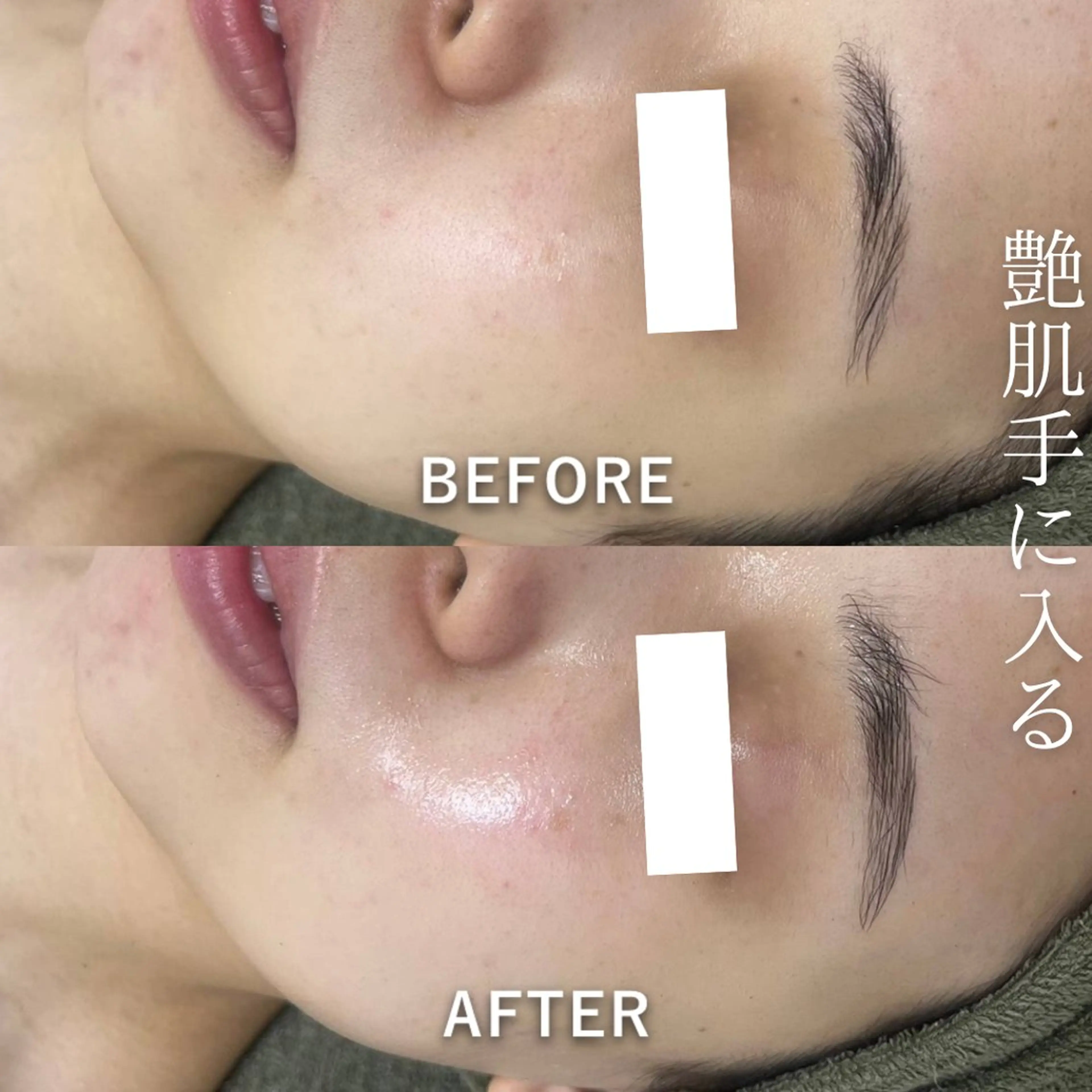 韓国美肌/肌質改善 【天神】のエステ・リラクイメージ