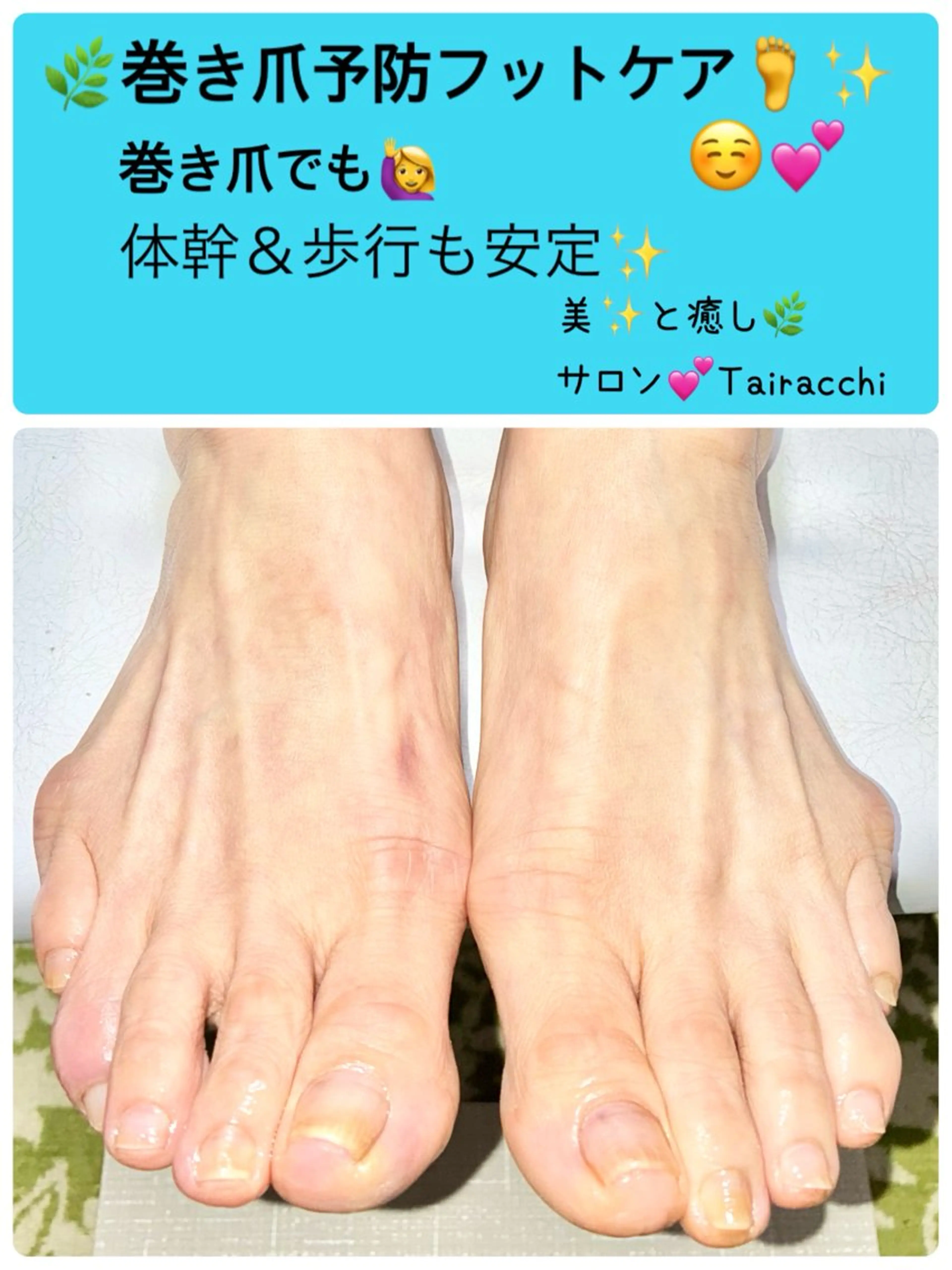 ネイル フットネイル Tairacchi ﾀｲﾗｯﾁのエステ・リラクイメージ