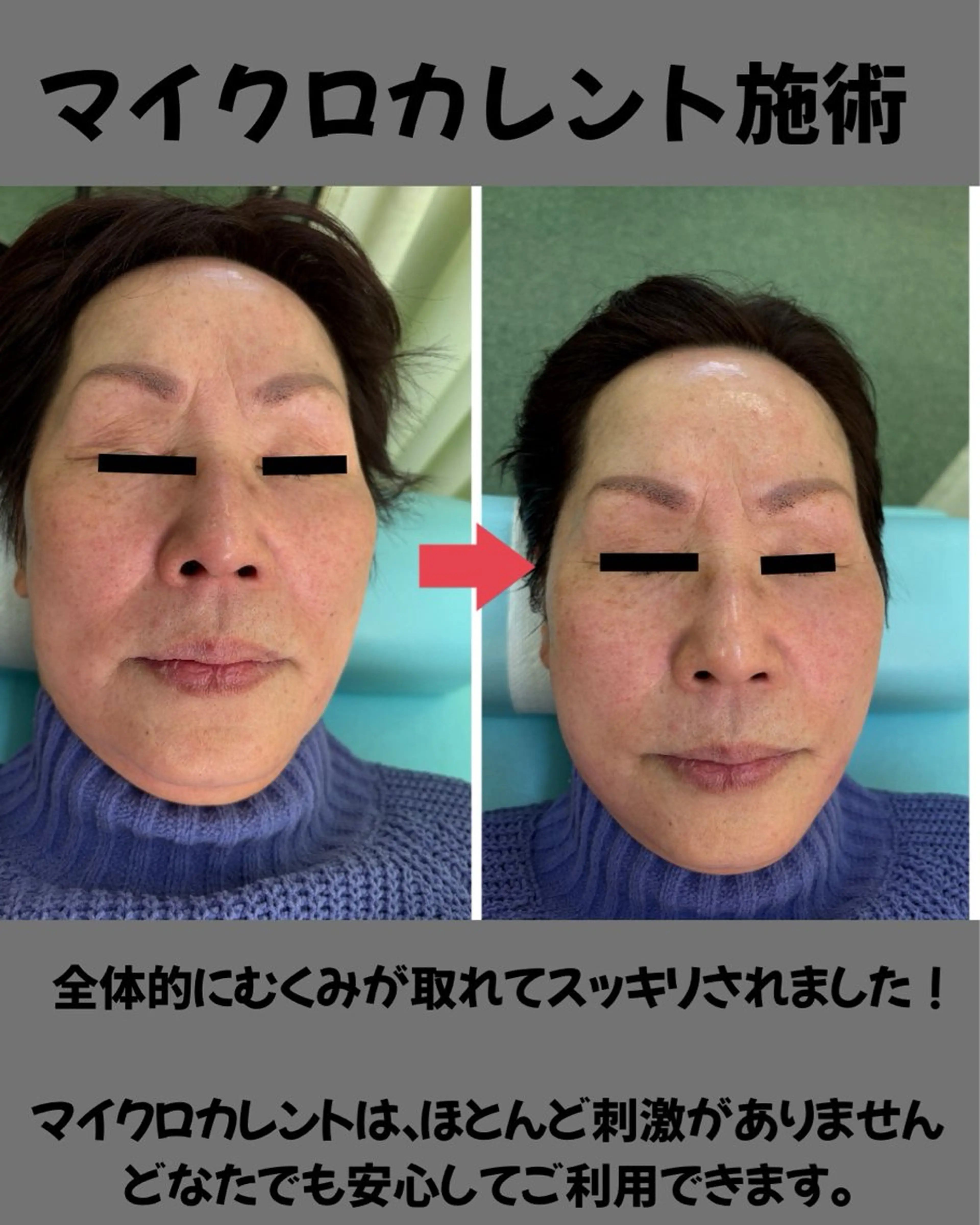 あおぞら 鍼灸整骨院のエステ・リラクイメージ