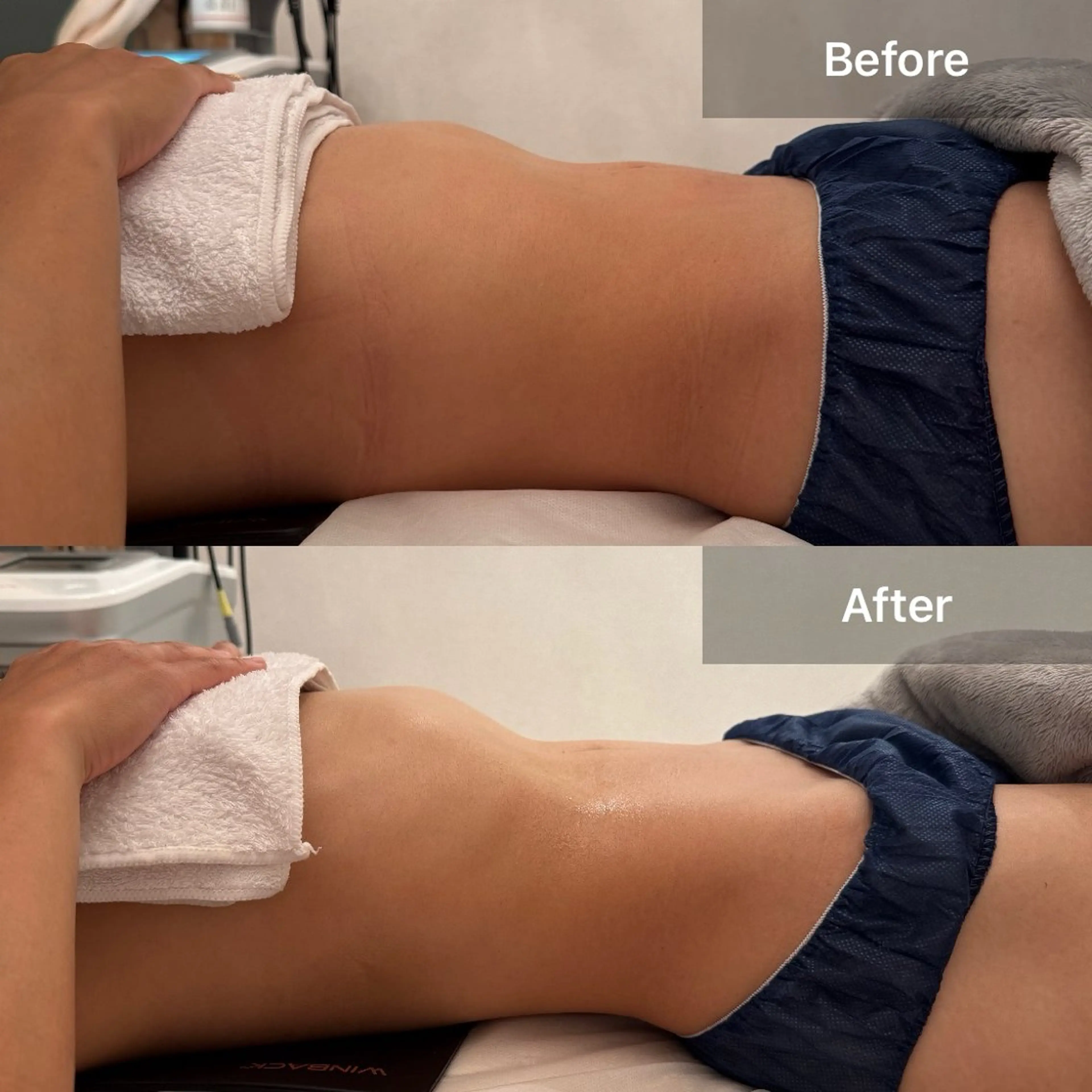 エステ リラク Lune’as Spa 南青山🫧のエステ・リラクイメージ