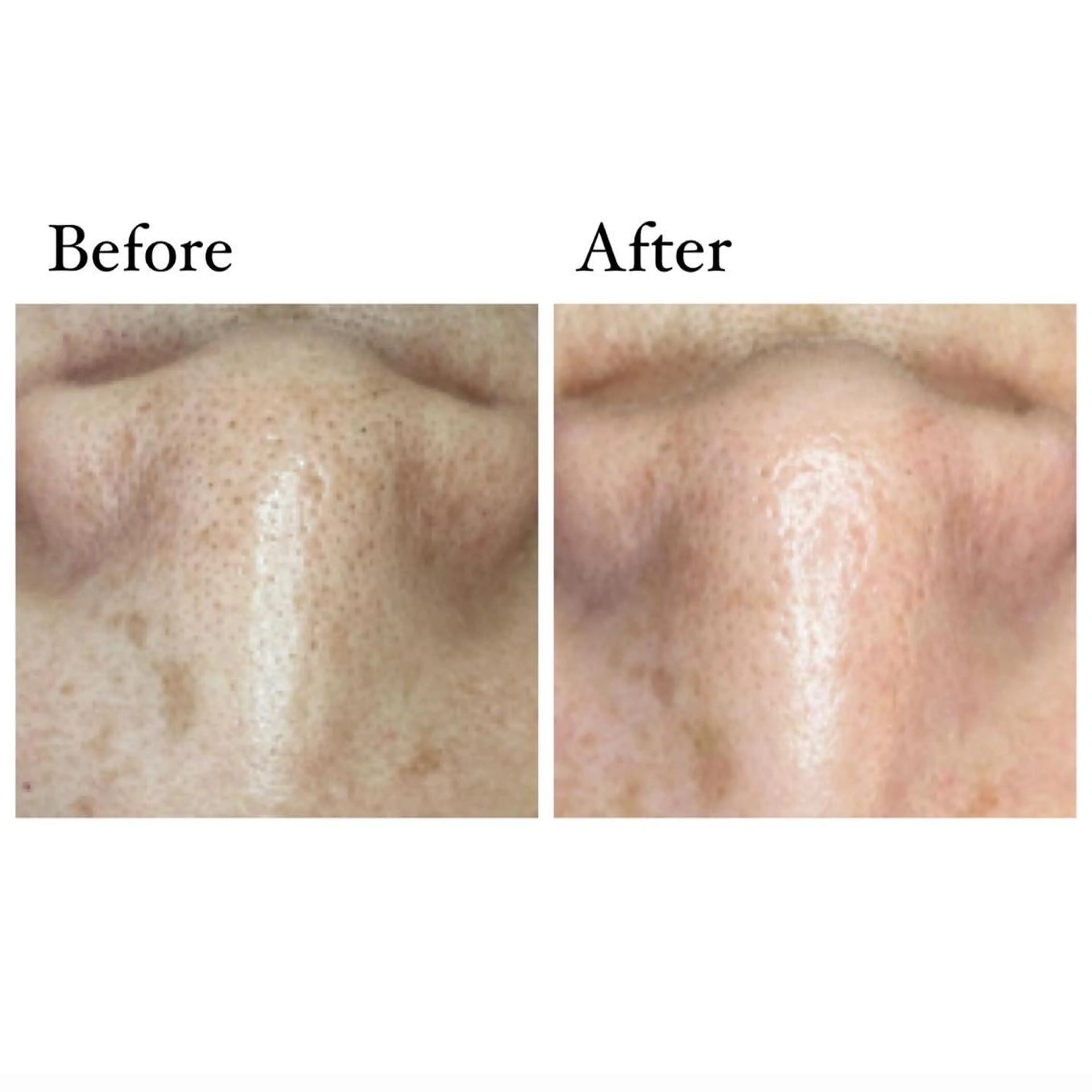 ニキビ/敏感肌/乾燥 Lilyauraのエステ・リラクイメージ