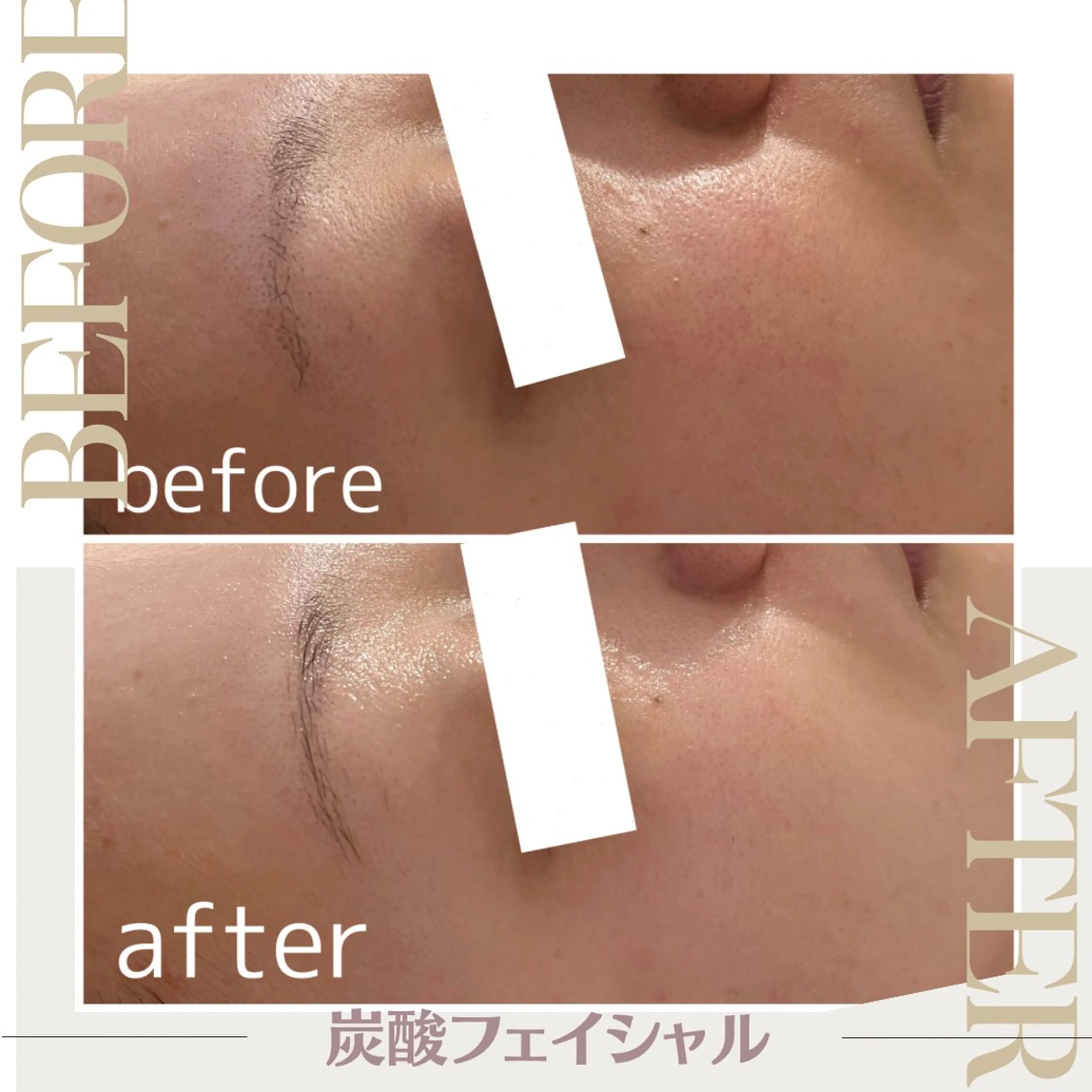 エステサロン シェリーのエステ・リラクイメージ