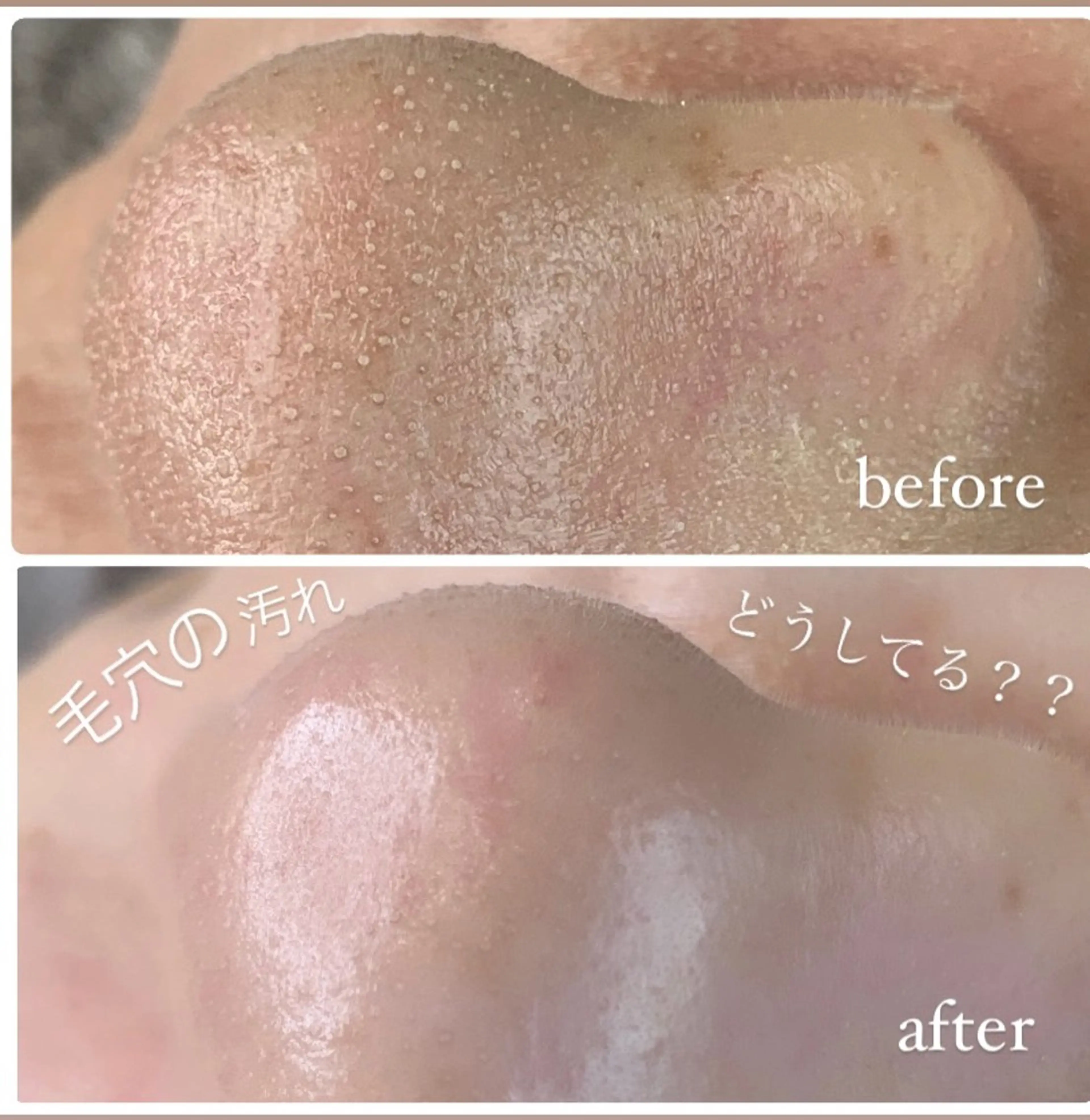 鼻先から透明感✨実感!【鼻のみ】鼻スパ毛穴洗浄+ワックスの写真
