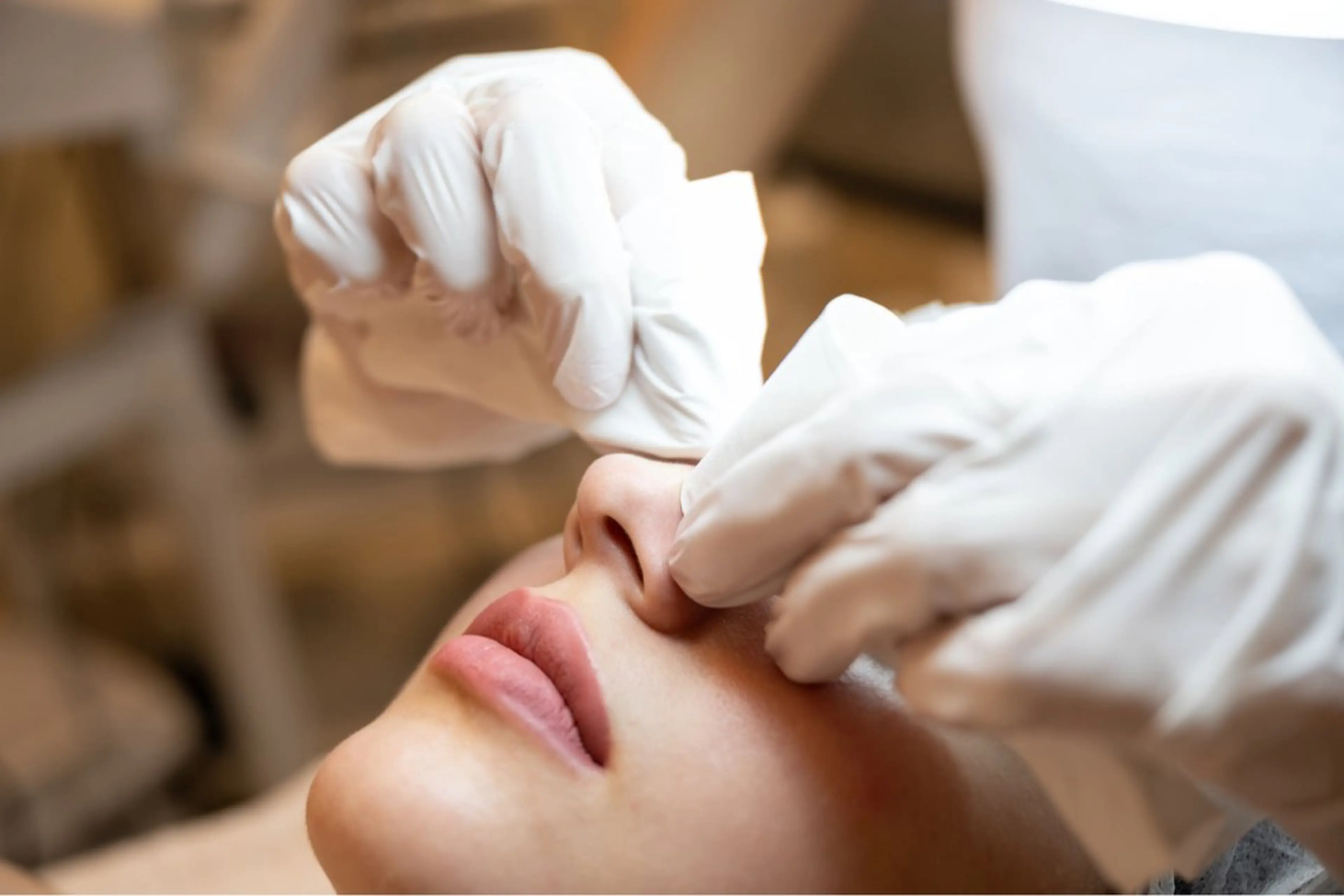 【平日限定特別割引❣️】毛穴エクストラクション＋炭酸パックコースの写真