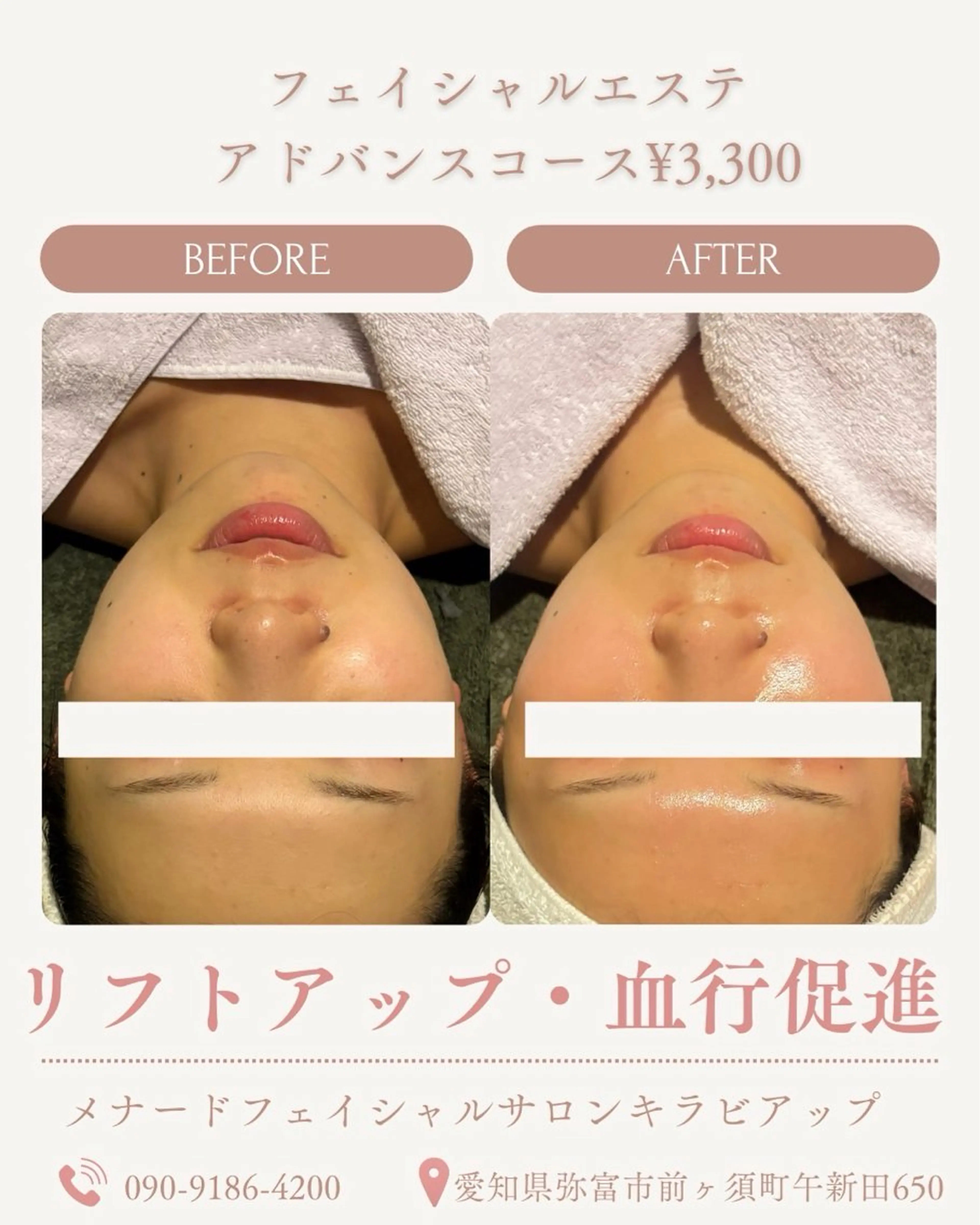 MENARDフェイシャルサロン　キラビアップ所属・🎀あみ/リンパケア /毛穴/くすみ/シワのエステ・リラクイメージ