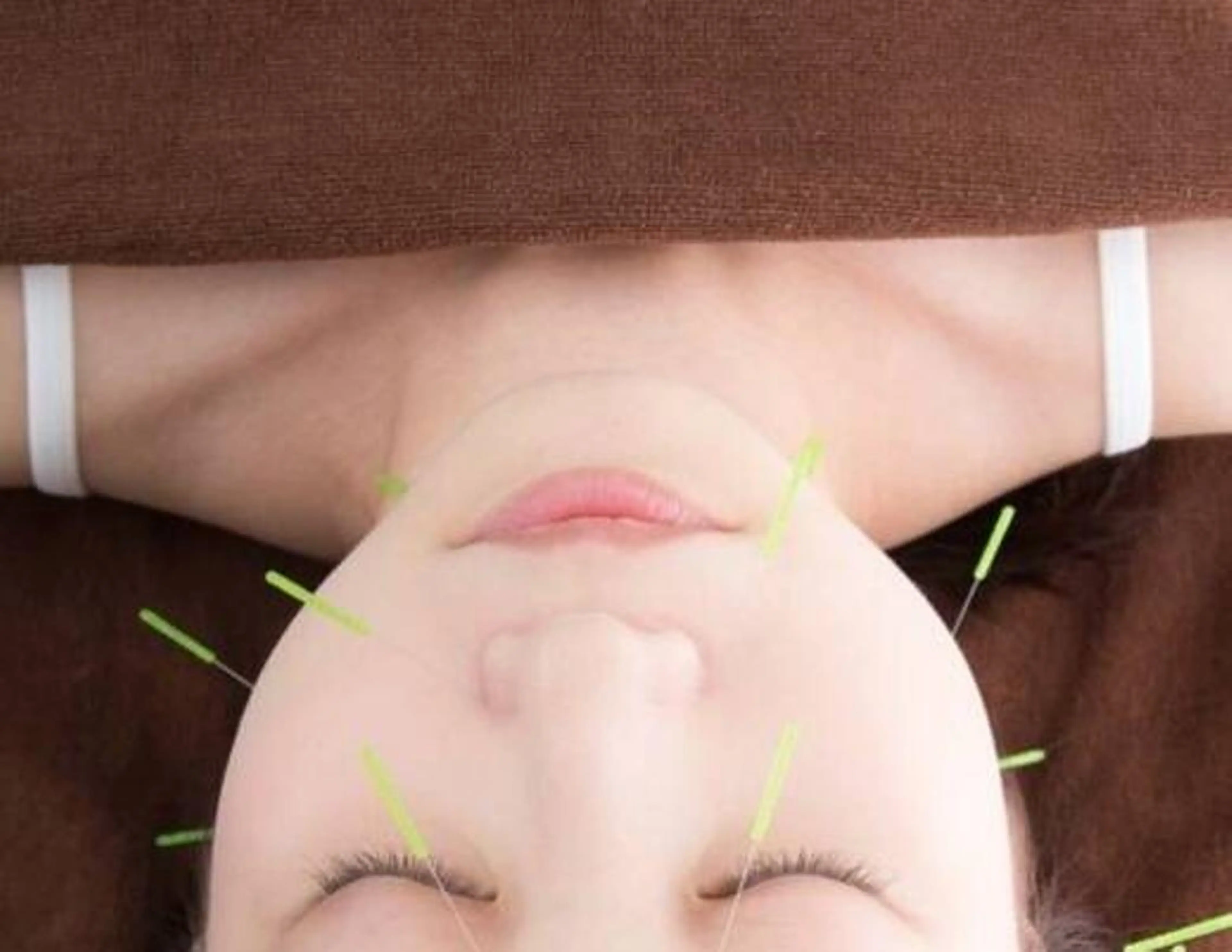 鍼灸・整体・美容鍼  ハリエ　おだのエステ・リラクイメージ