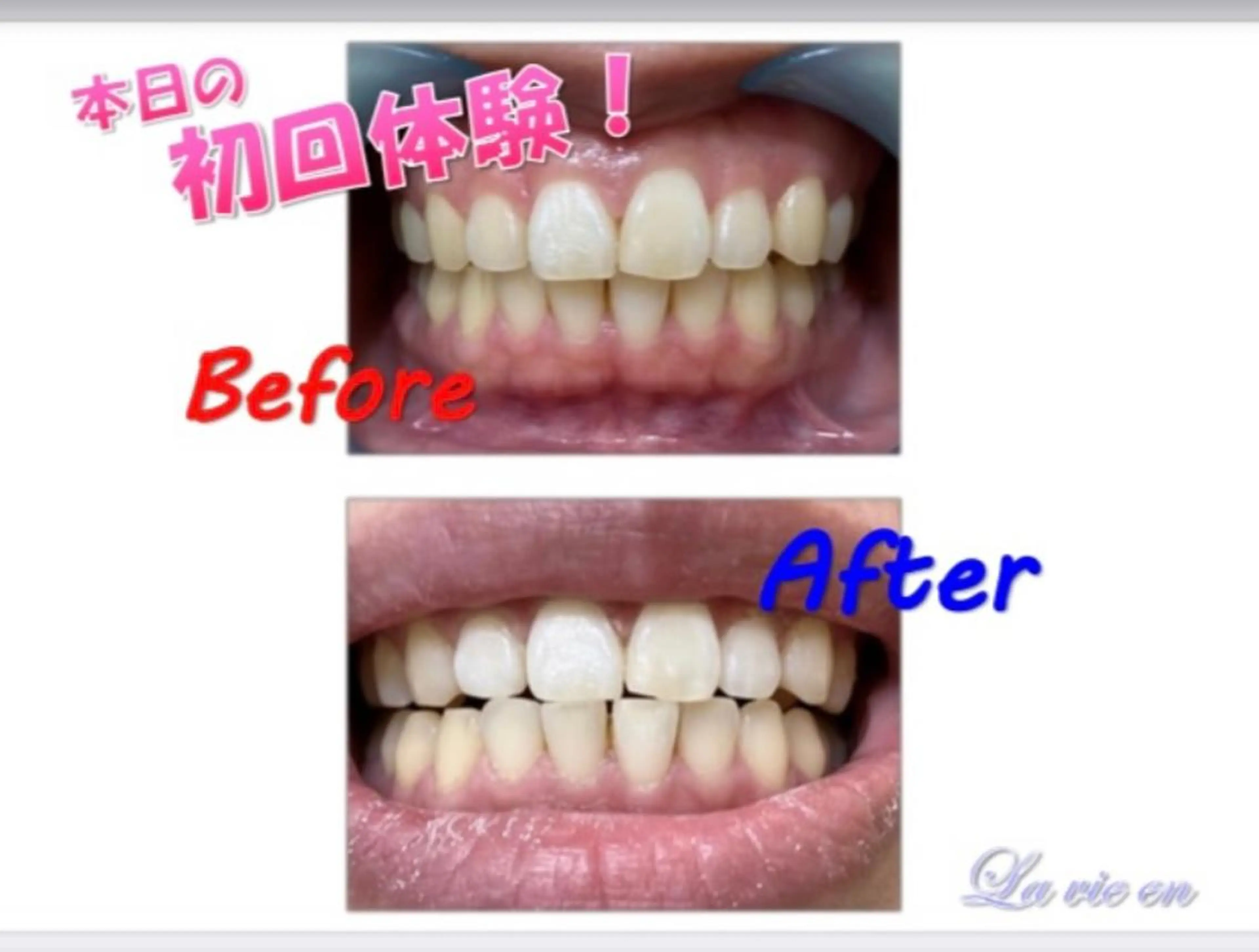 その他 ホワイトニングサロン La vie enのその他イメージ