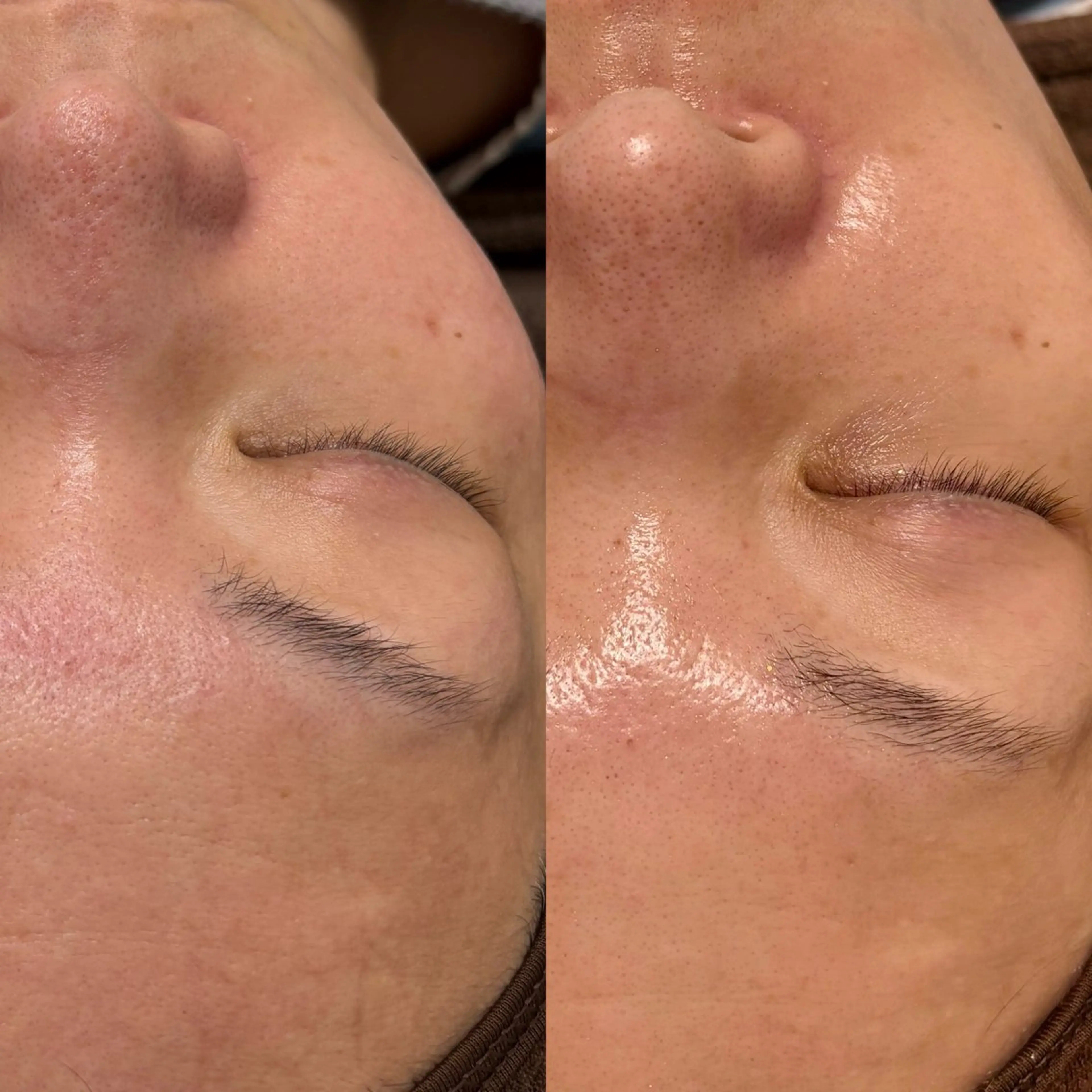 はり灸サロン　totonoi所属・印象の良くなる 美容鍼のエステ・リラクイメージ