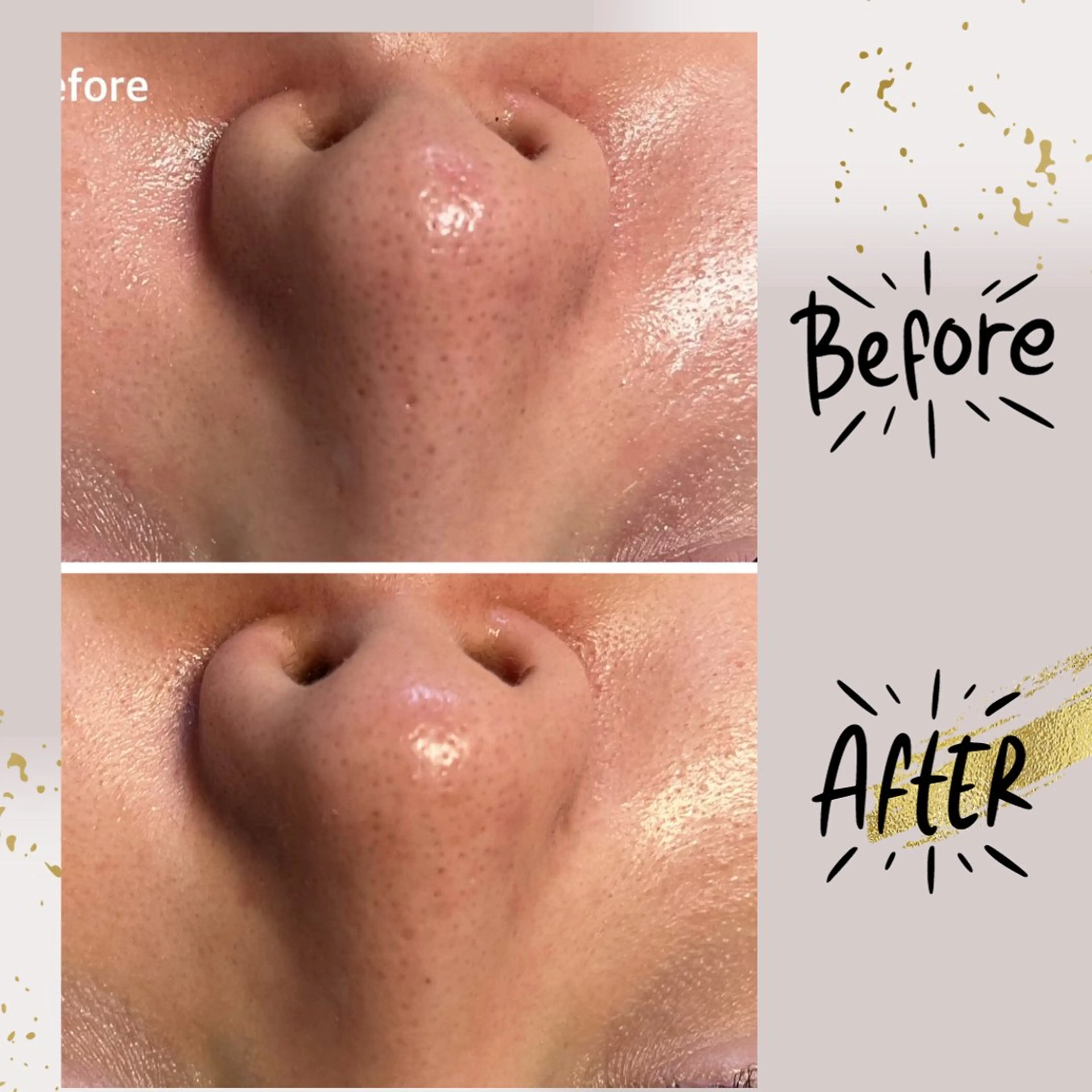 ピーリング専門店 Belluteのエステ・リラクイメージ