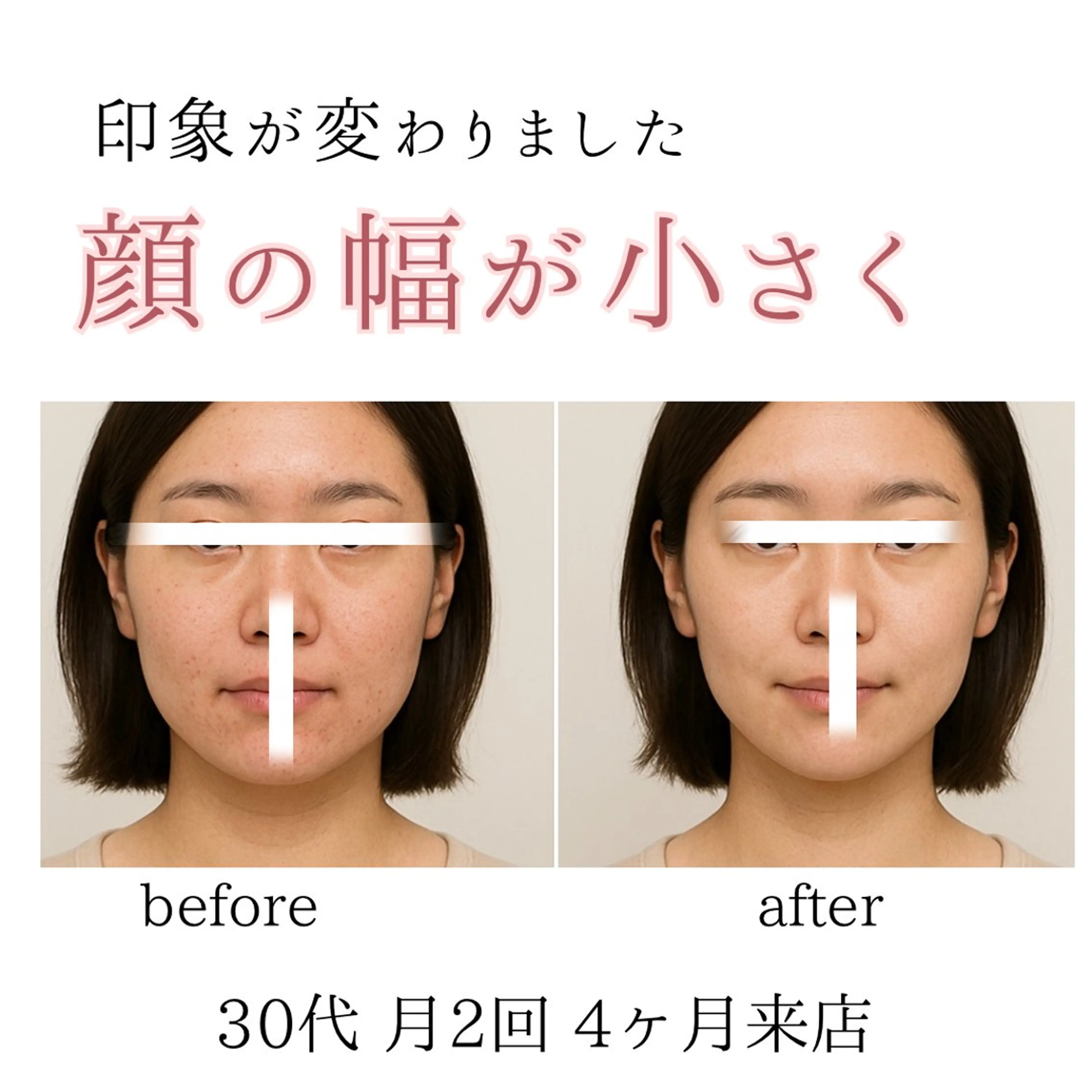 小顔・ニキビ ・脱毛サロンのエステ・リラクイメージ