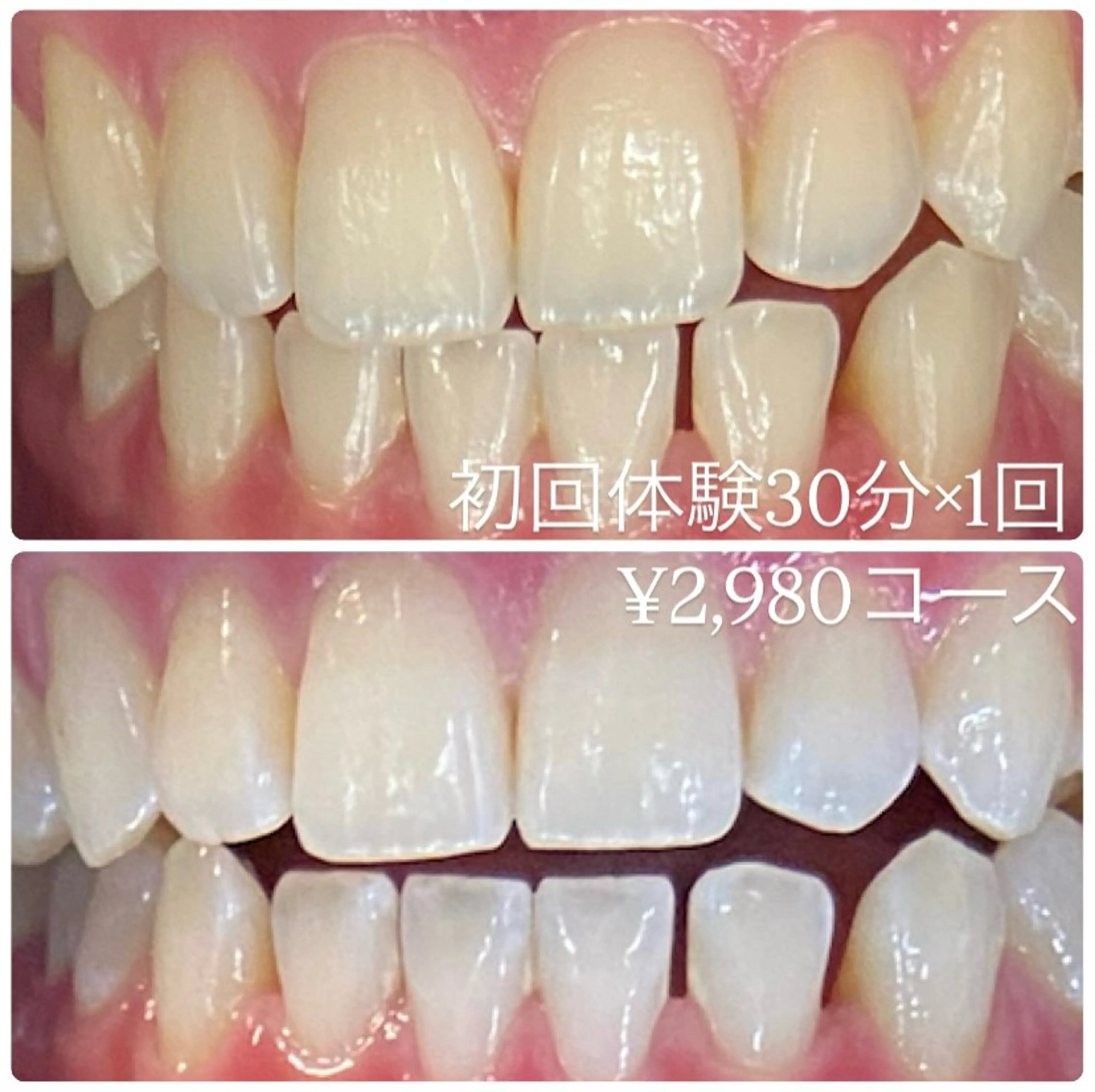 PLATINUM Beauty 横浜店所属・ホワイトニングルーム 横浜店のその他イメージ