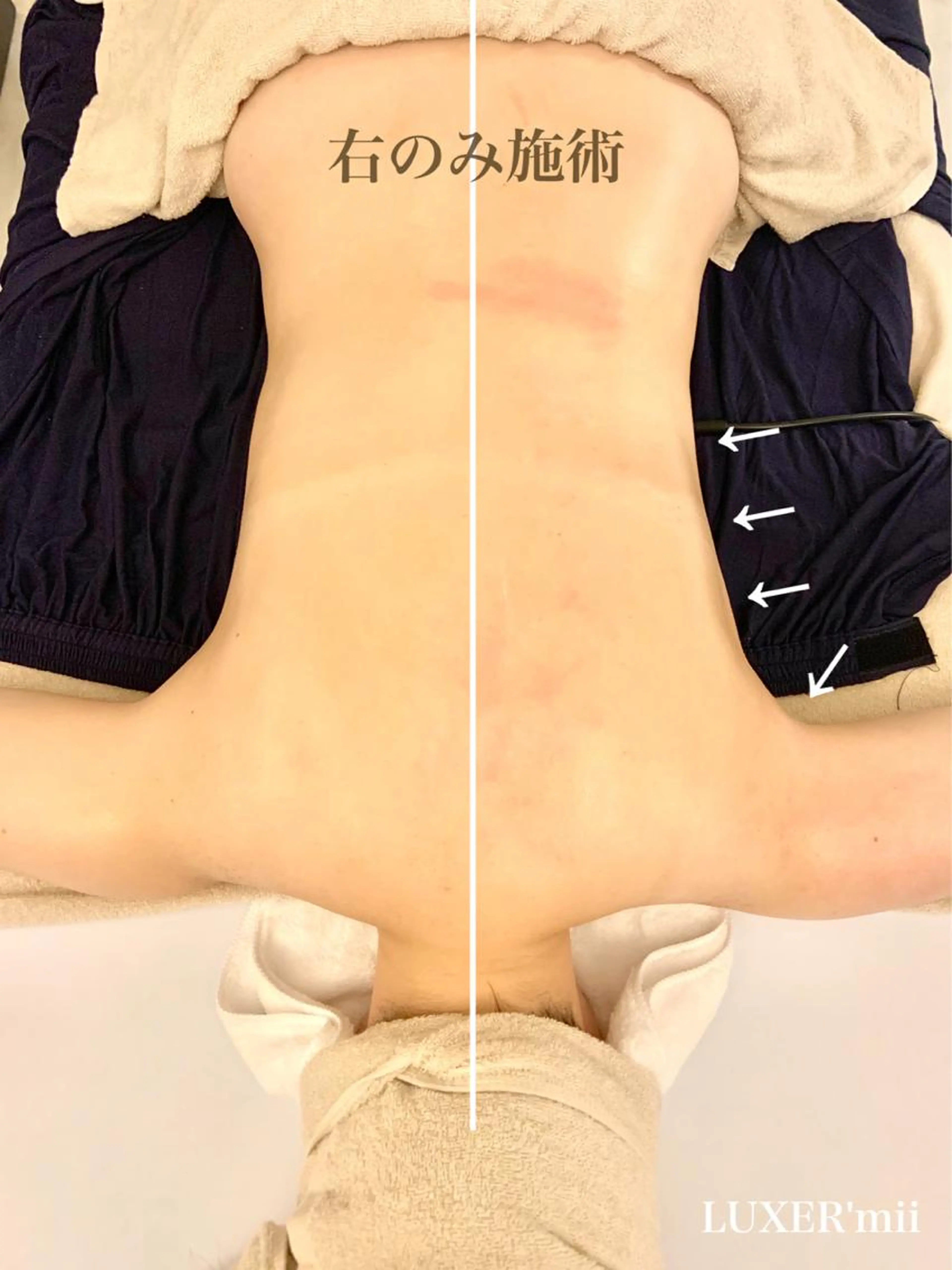 人気No.1！WINBACK＋小顔＆背中コルギ（デコルテ付）95分の写真