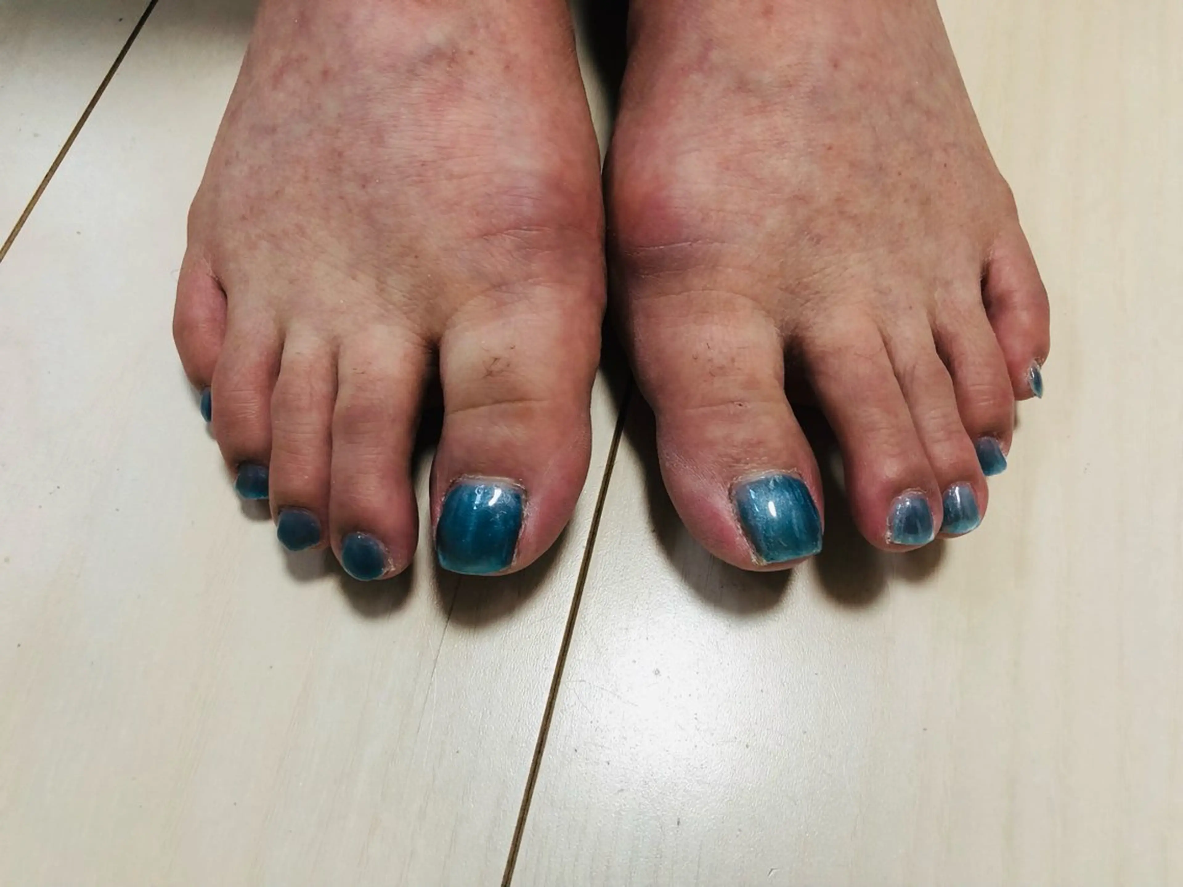 ネイル ブルー フットネイル マグネットネイル M&Y nailsalonのネイルデザイン