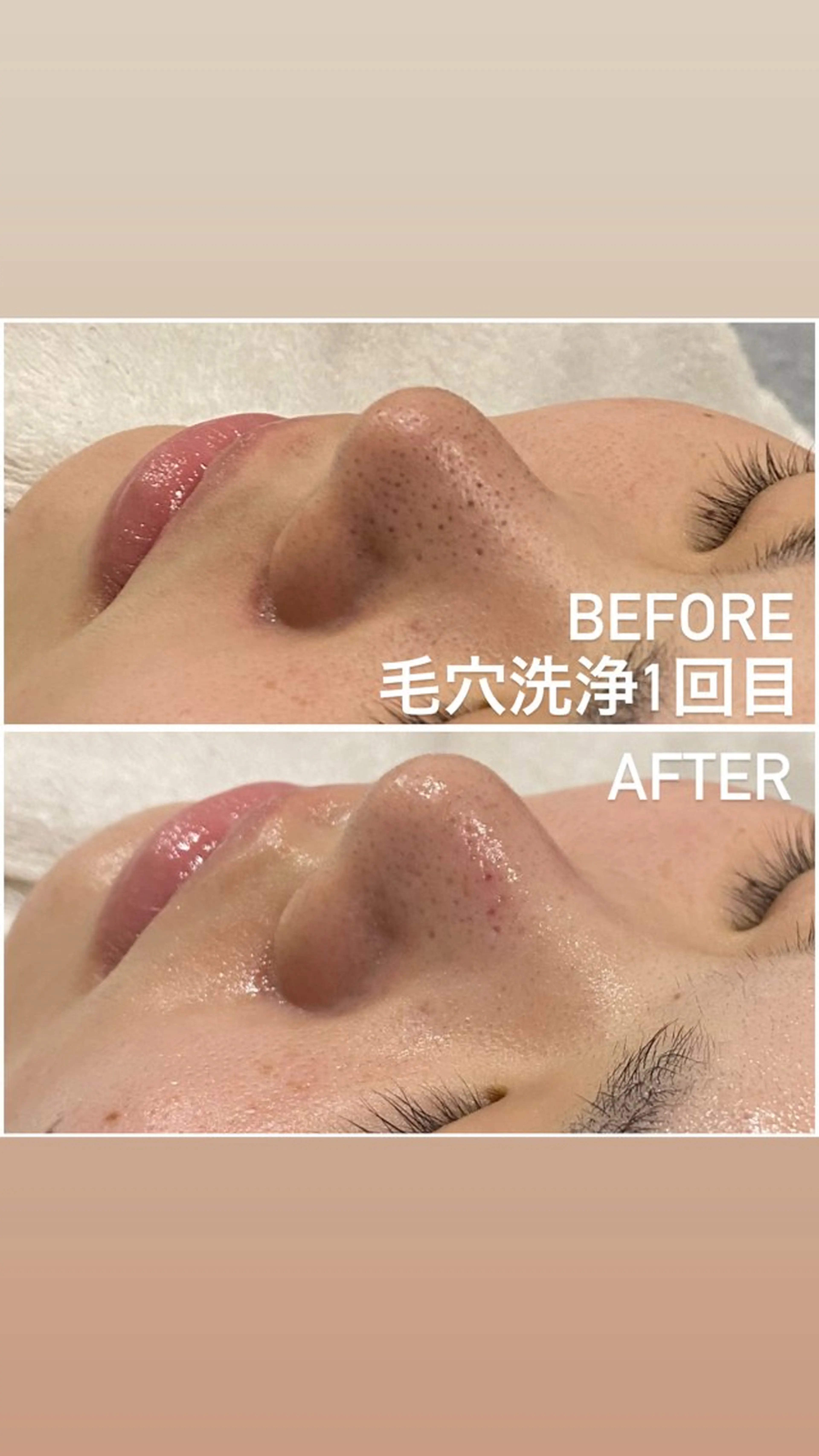 エステ 毛穴洗浄・痩身・脱毛 /アルカンジュのエステ・リラクイメージ