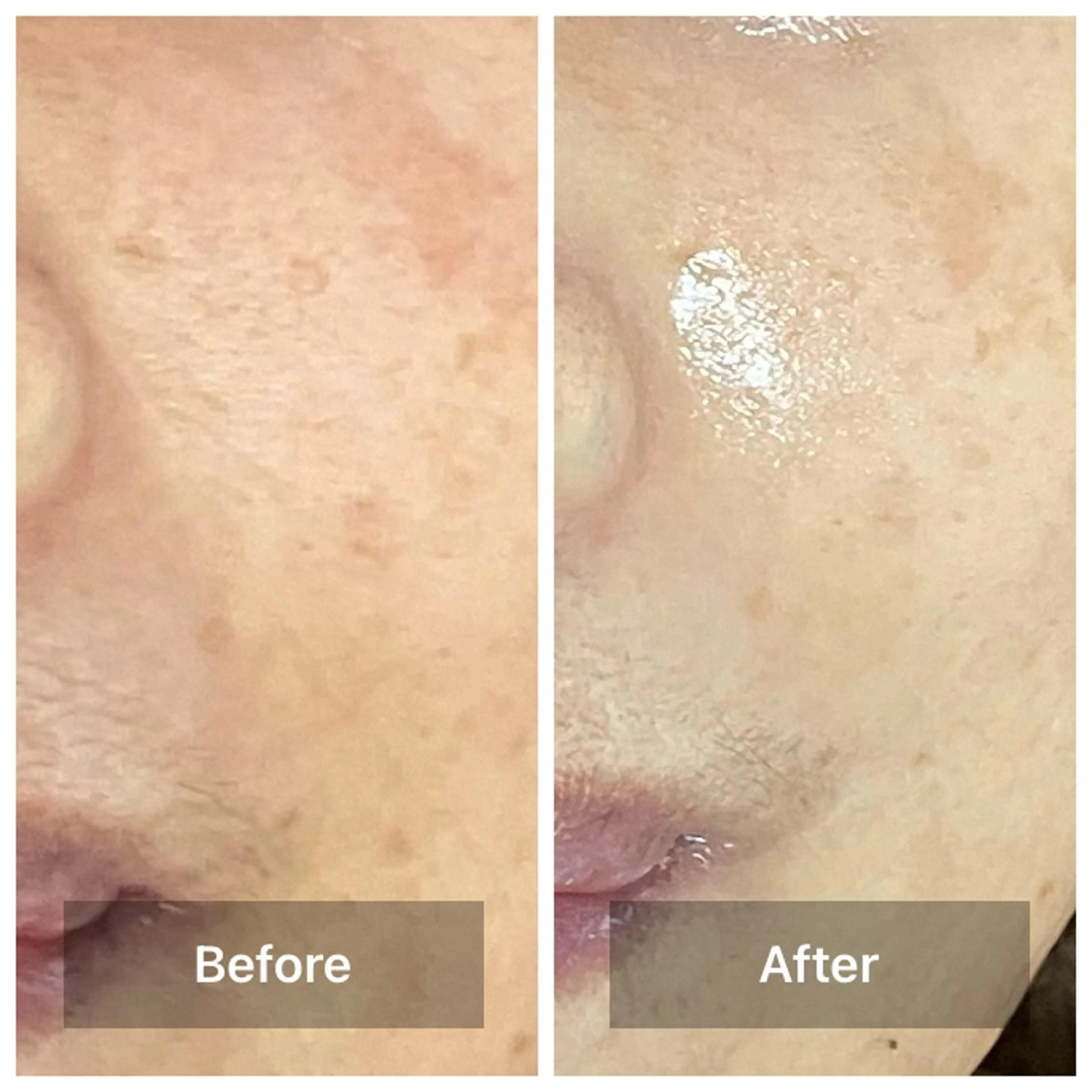 エステ リラク bonuru salonのエステ・リラクイメージ