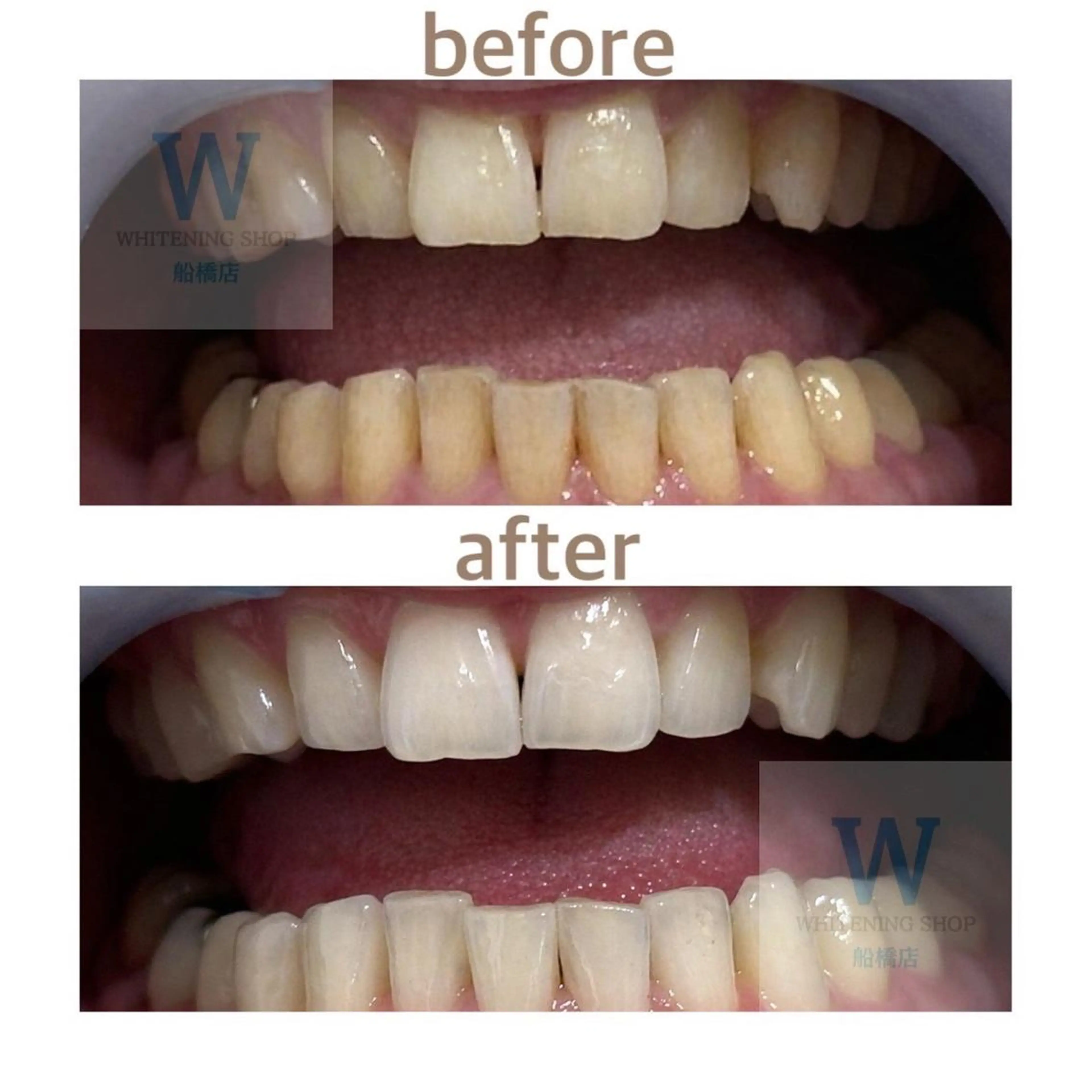 エステ リラク ホワイトニング ショップ船橋店🦷のエステ・リラクイメージ