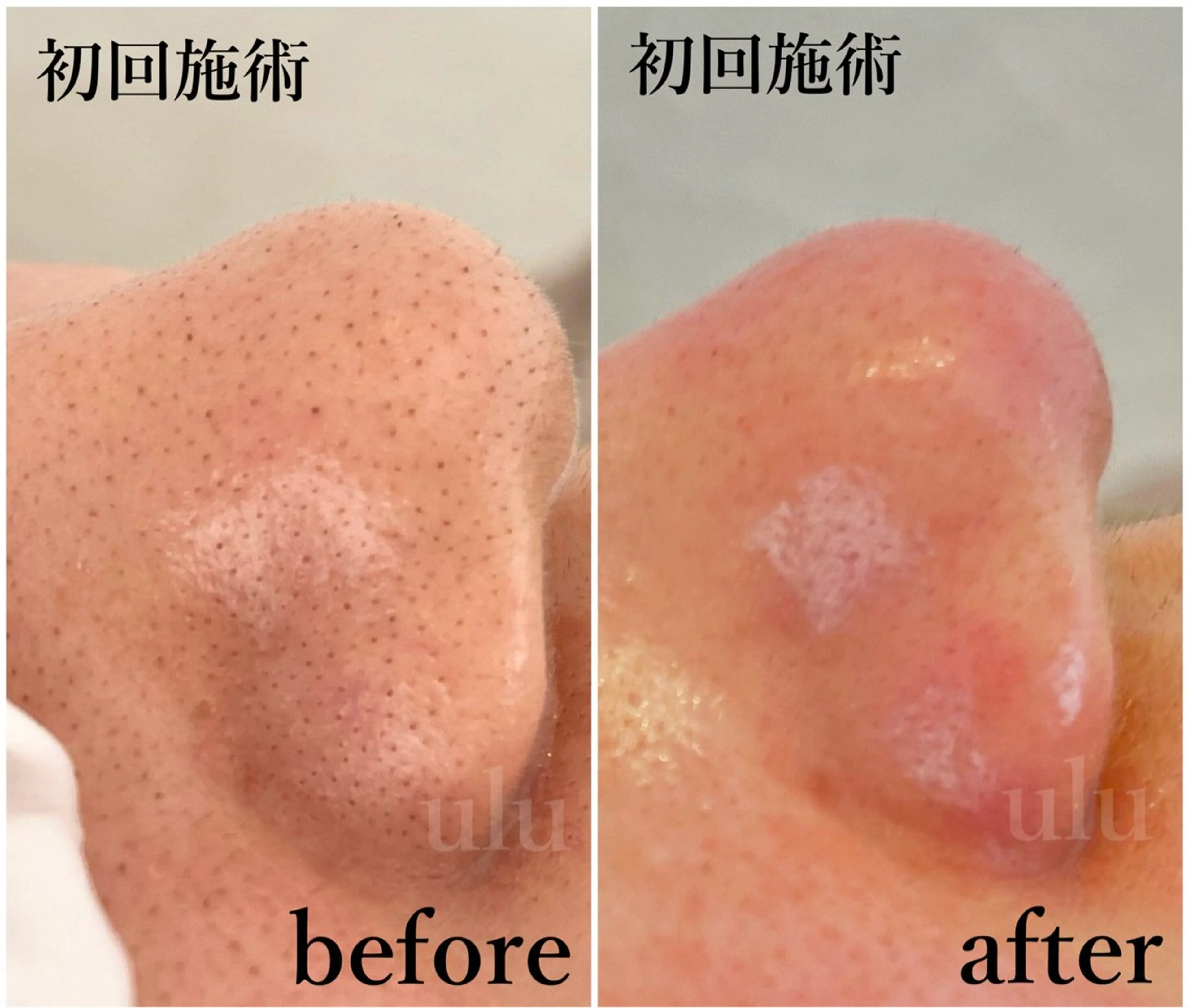 beauty salon uluの眉毛・アイブロウイメージ