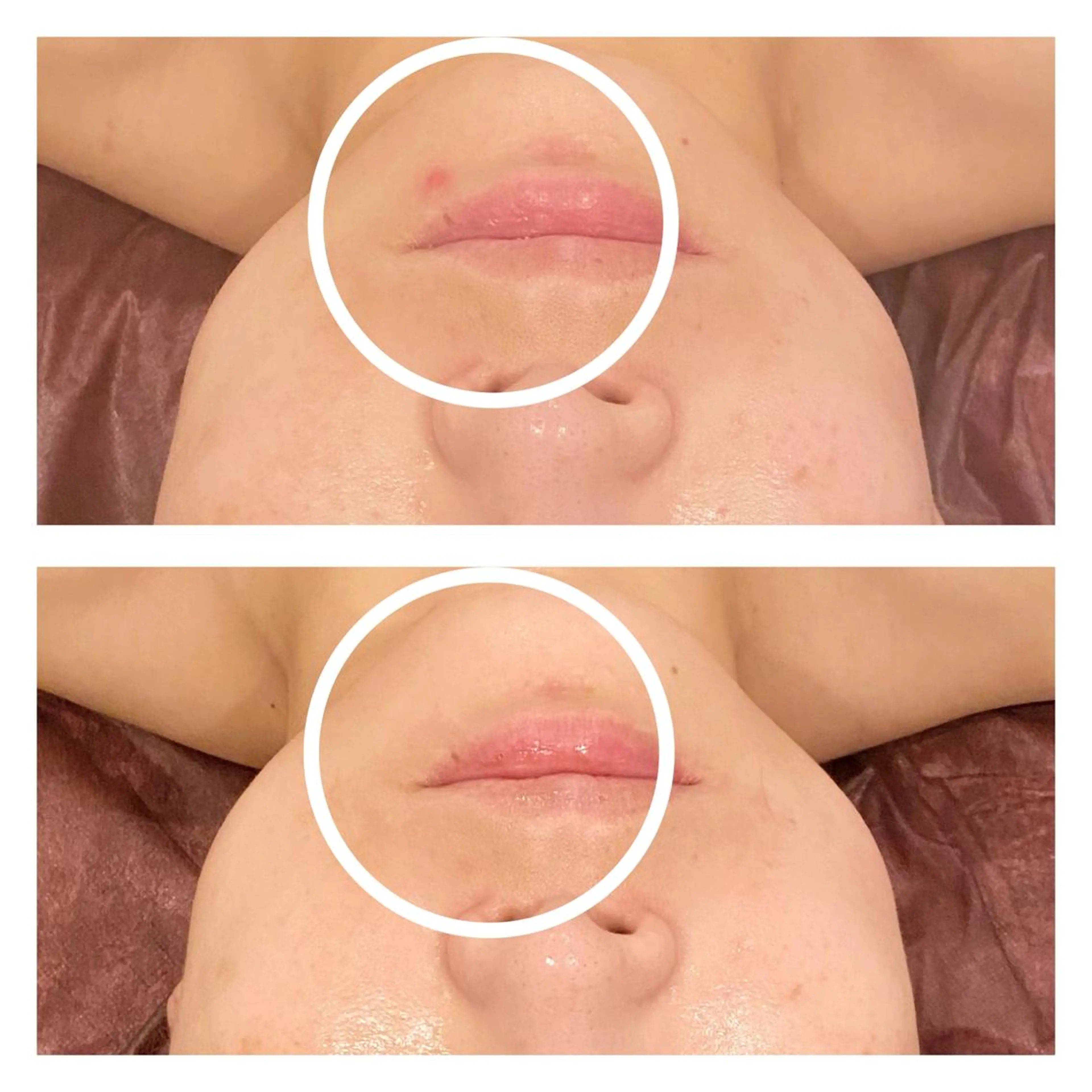 エステ リラク 小顔EX心斎橋 REVIハーブのエステ・リラクイメージ